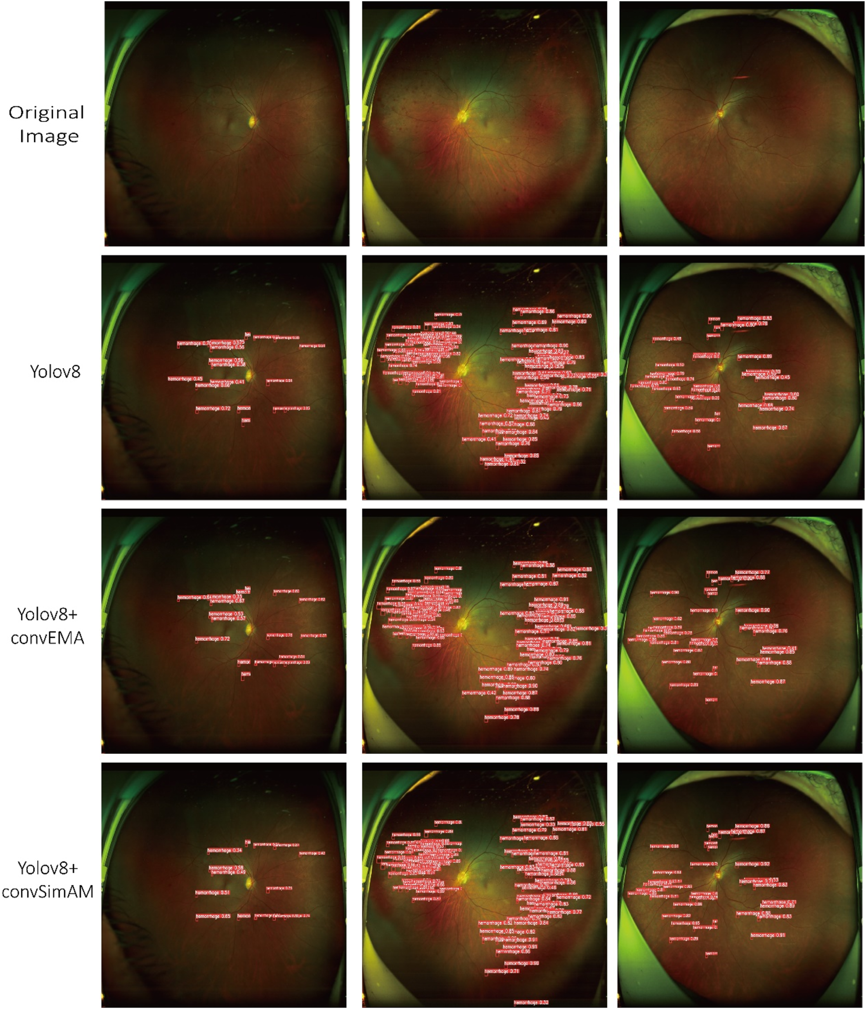 A grid of retinal images with different detection methods. The first row shows original images, the second row displays results using Yolov8, the third with Yolov8 plus convEMA, and the fourth with Yolov8 plus convSimAM. Each method marks various retinal features with red labels, differing in density and distribution across the methods.