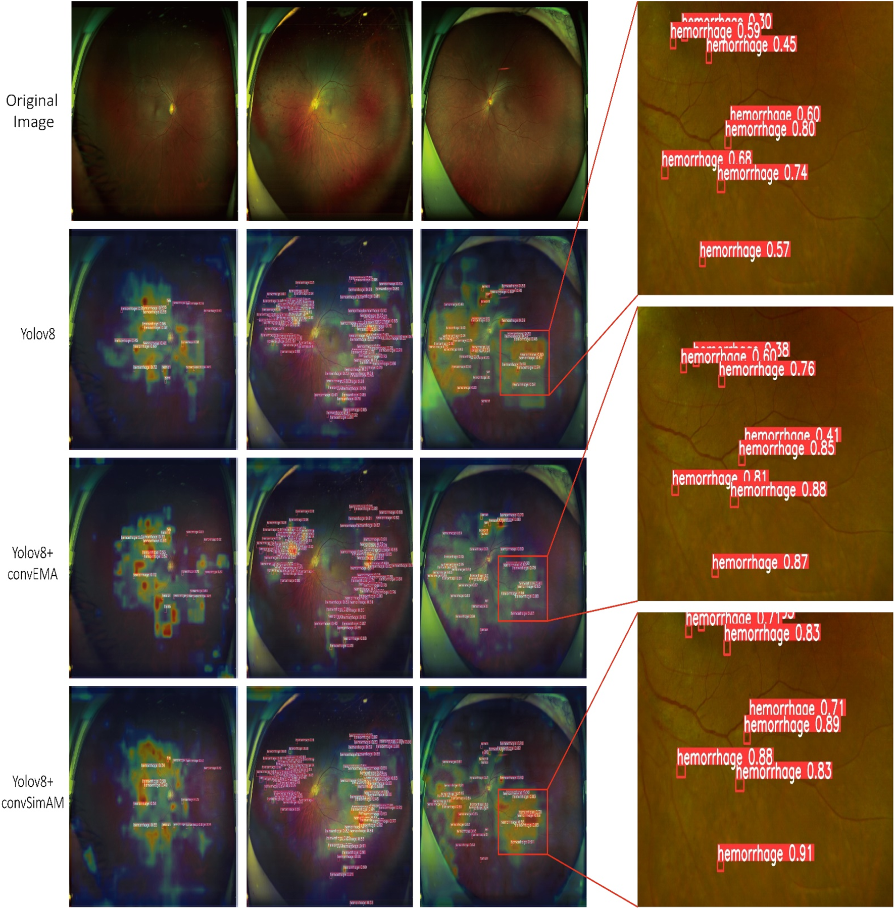 Images compare different models detecting hemorrhages in retinal scans. The top row shows original images. Subsequent rows display results from YOLOv8, YOLOv8+convEMA, and YOLOv8+convSimAM models, with hemorrhage areas highlighted and labeled with detection confidence scores.