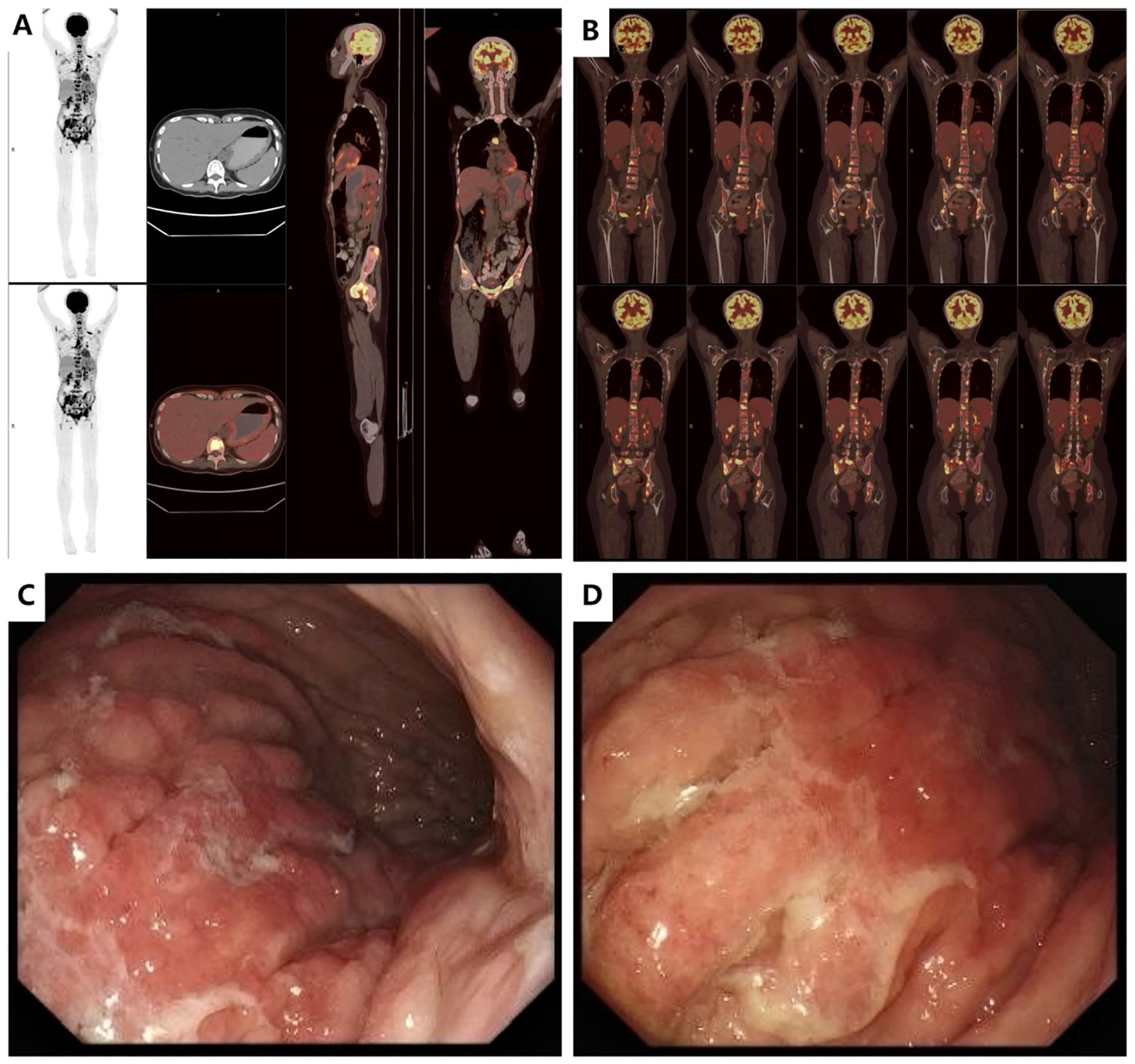 Four CT scan images labeled A, B, C, and D show cross-sections of the abdominal area. Each image captures different anatomical structures, highlighting the kidneys, spine, and surrounding organs in varying detail.