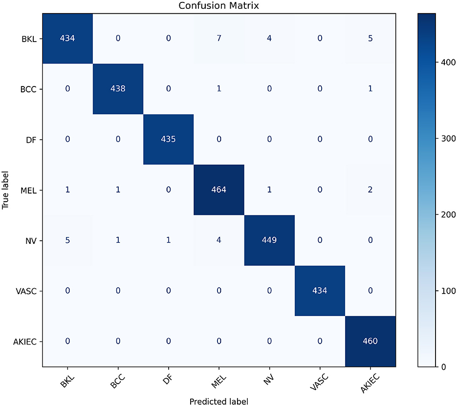 Confusion matrix for a classification model showing true labels versus predicted labels for seven categories: BKL, BCC, DF, MEL, NV, VASC, and AKIEC. Diagonal values represent correct predictions, with high numbers for each category, indicating strong performance. Off-diagonal values indicate misclassifications, which are relatively low.
