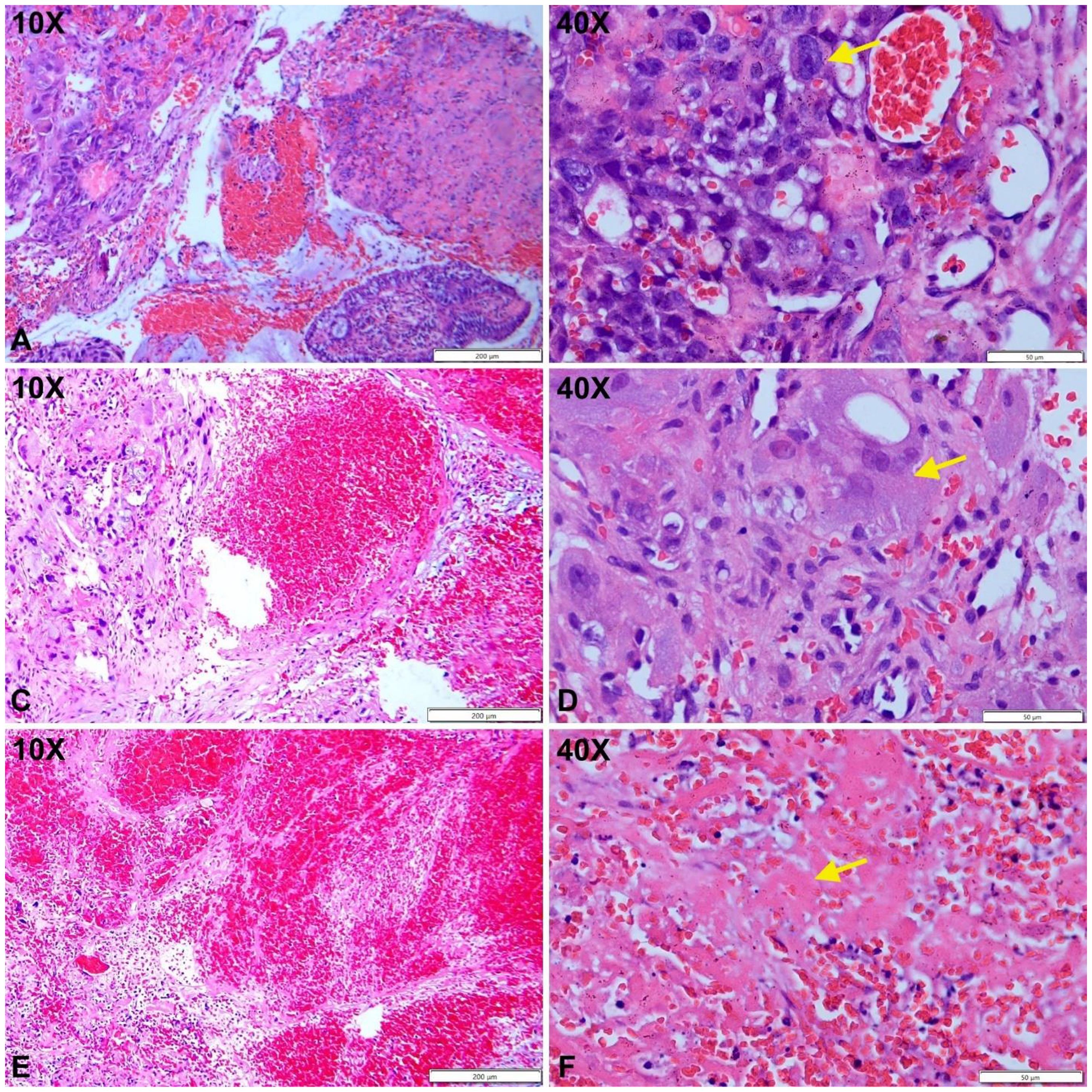 Histological images showing stained liver tissue under different magnifications. Panels A, C, and E display tissue at ten times magnification, highlighting structural changes. Panels B, D, and F show sections at forty times magnification, with arrows pointing to specific areas of interest in each section, indicating cellular changes and characteristics. Each image features a scale bar for reference.