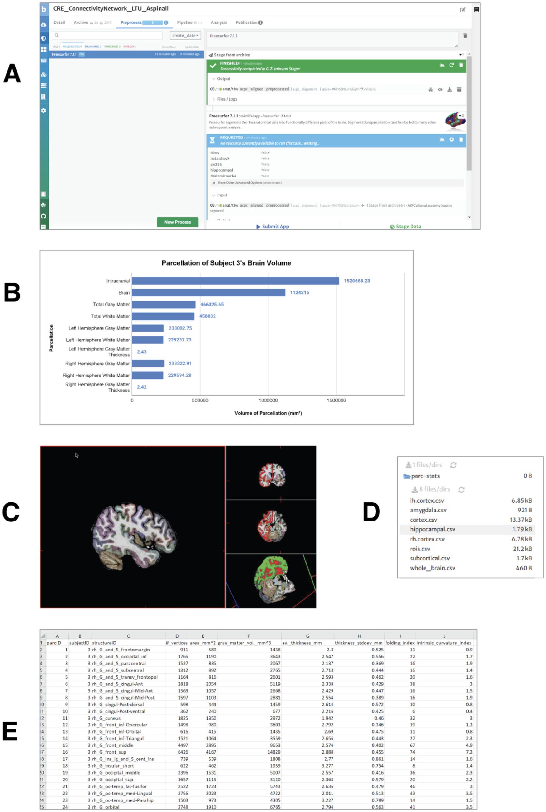 A multi-panel image showing different elements related to brain analysis. Panel A displays a software interface for processing brain scans using Freesurfer. Panel B is a bar chart titled