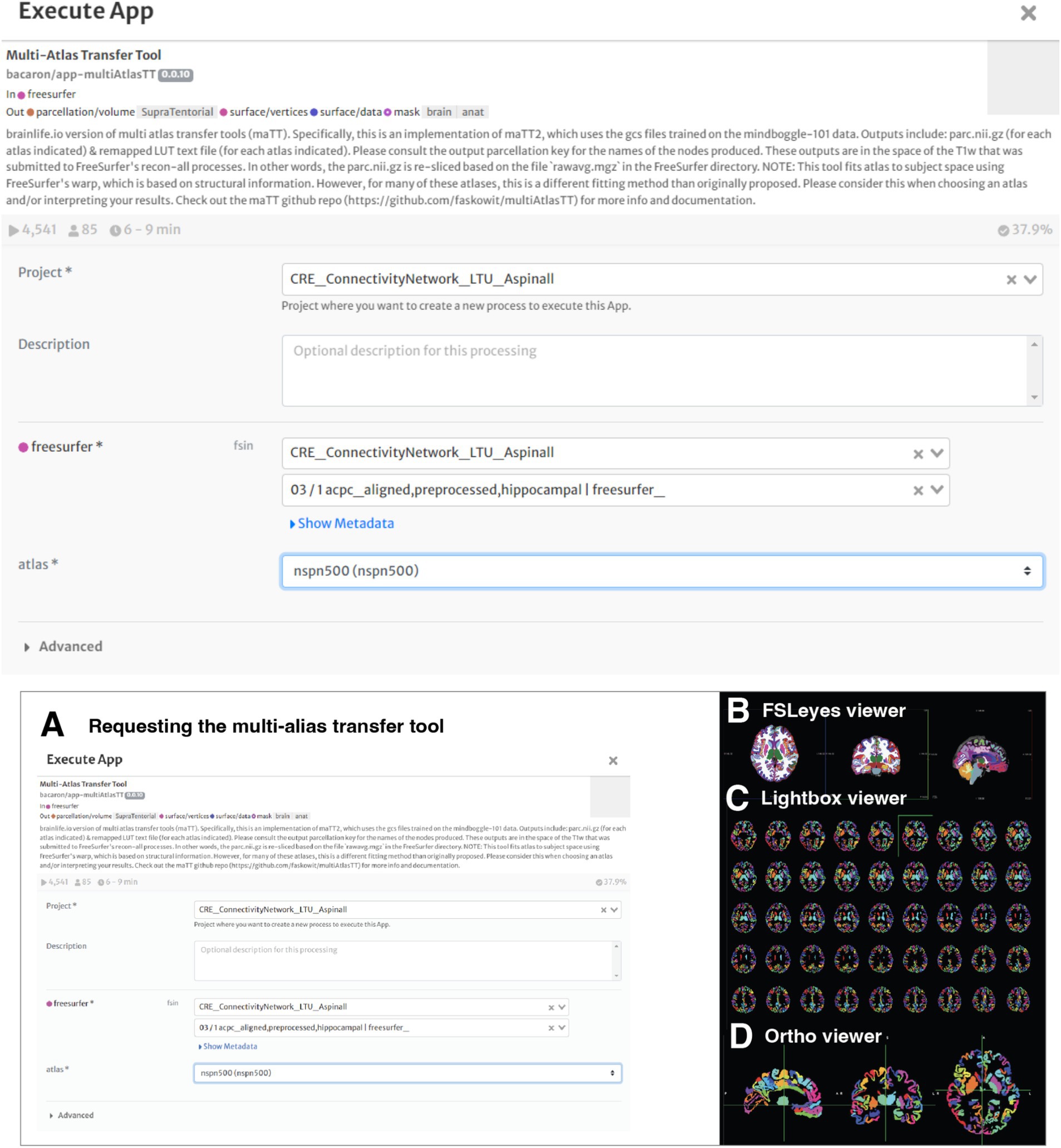 Interface of an app for a multi-atlas transfer tool within Freesurfer. Panel A displays settings for running the app, such as project, input file, and atlas. Panels B, C, and D show different brain imaging viewers: FSLeyes viewer, Lightbox viewer, and Ortho viewer, each illustrating brain images with identified regions in various orientations and slices.