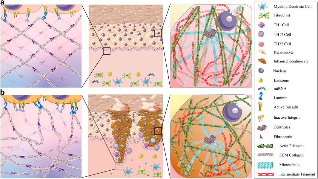 actually focuses on demonstrating the differences in the extracellular matrix and keratinocyte cytoskeleton between normal skin and psoriatic skin.