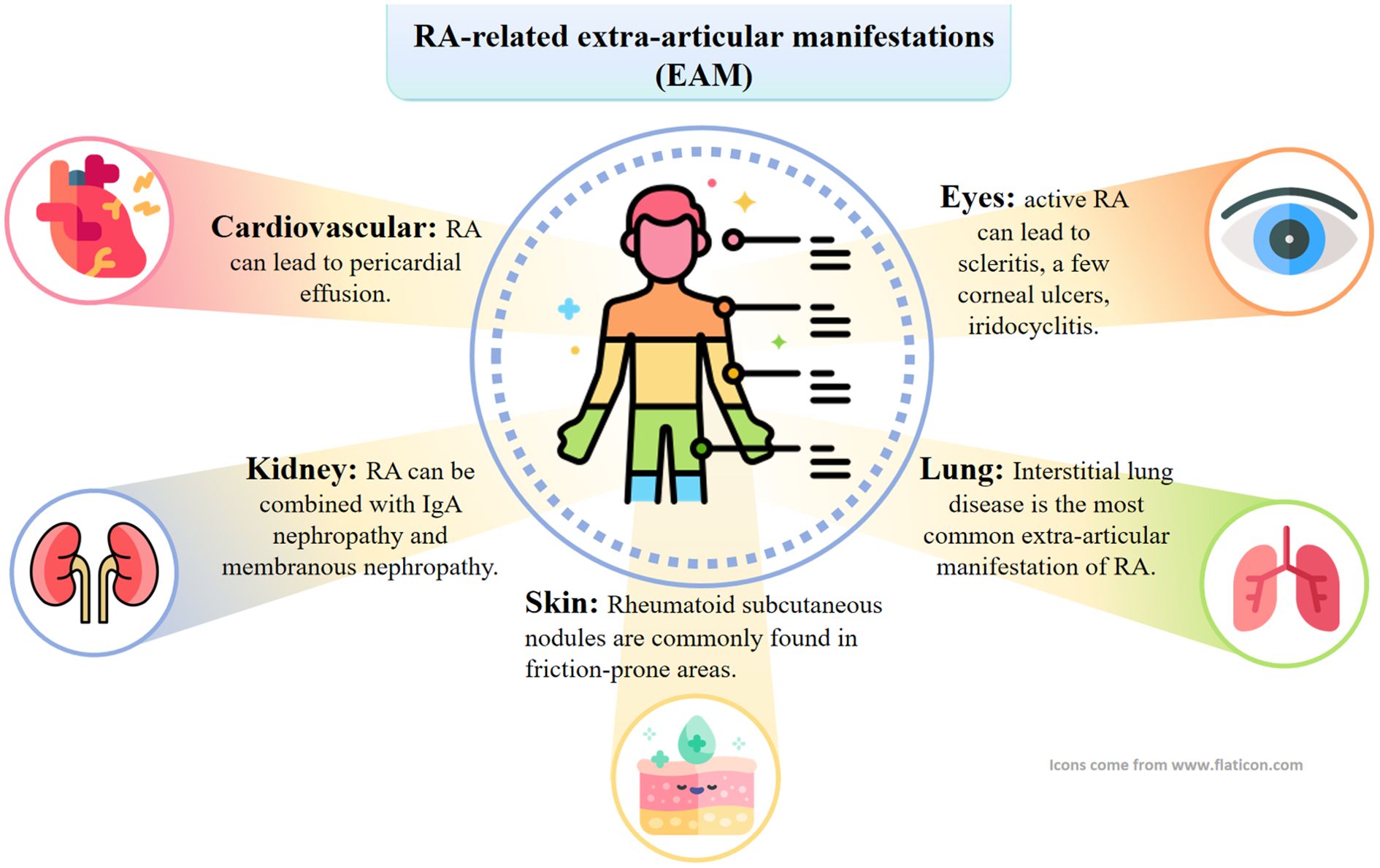 Diagram illustrating RA-related extra-articular manifestations. It includes cardiovascular issues like pericardial effusion, kidney problems such as IgA nephropathy, lung interstitial disease, eye conditions like scleritis, and skin nodules. An anatomical figure highlights affected areas.