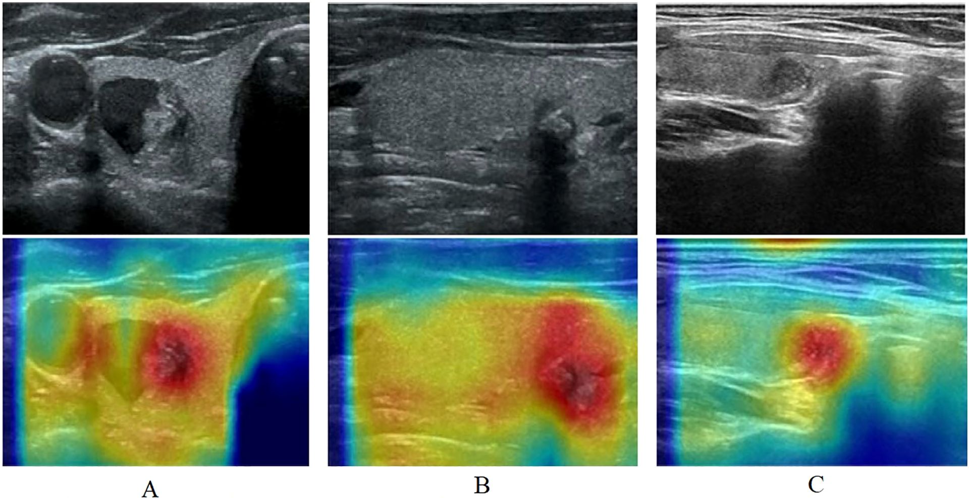 Three pairs of images display ultrasound scans and corresponding thermal images. The top row shows grayscale ultrasound scans of tissues, each with different formations. The bottom row illustrates the same areas with color-coded thermal imaging, highlighting temperature variations with red indicating warmer areas and blue cooler regions.
