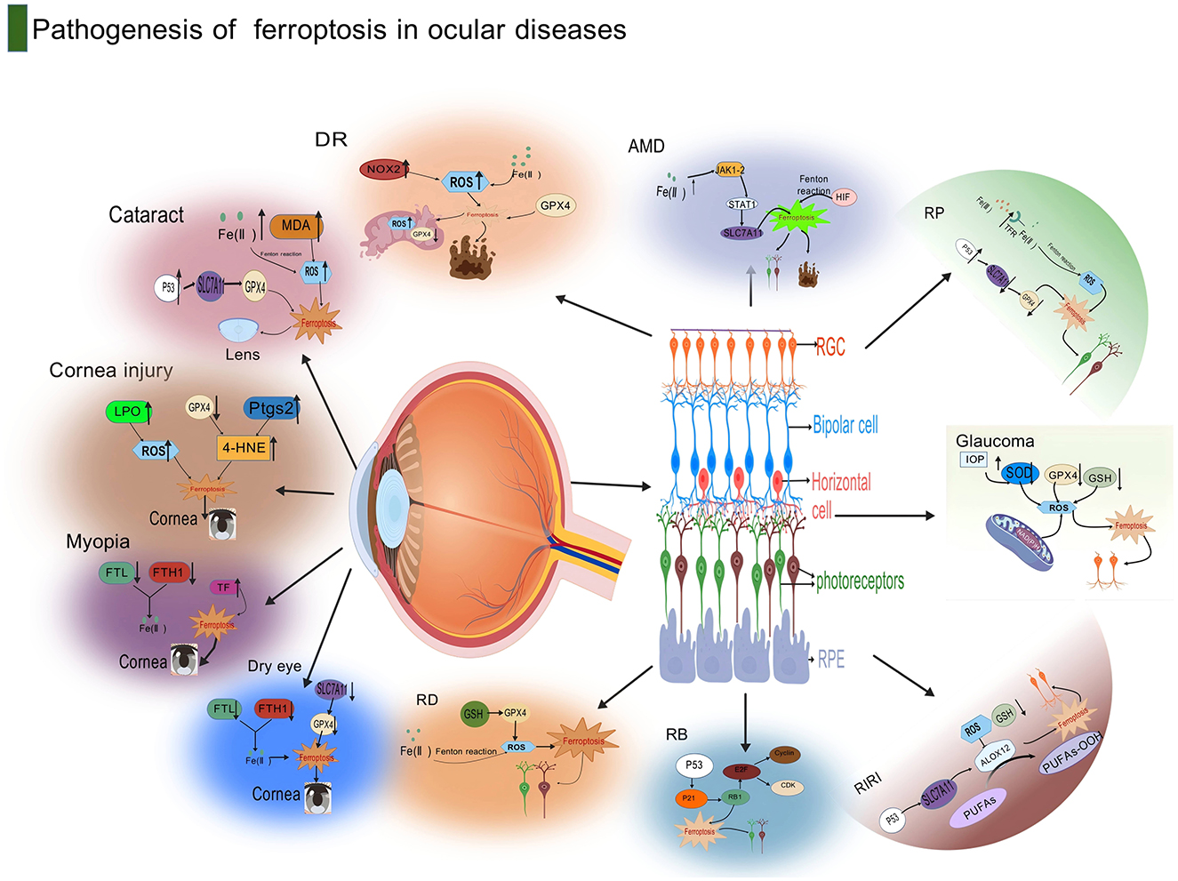 Diagram illustrating the pathogenesis of ferroptosis in ocular diseases, including cataract, cornea injury, myopia, dry eye, diabetic retinopathy (DR), age-related macular degeneration (AMD), retinitis pigmentosa (RP), glaucoma, retinal detachment (RD), retinoblastoma (RB), and retinal ischemia-reperfusion injury (RIRI). The image features various biochemical pathways and molecules such as ROS, GPX4, and MDA, depicted within eye structures. Arrows indicate the progression and effects of ferroptosis in these conditions.