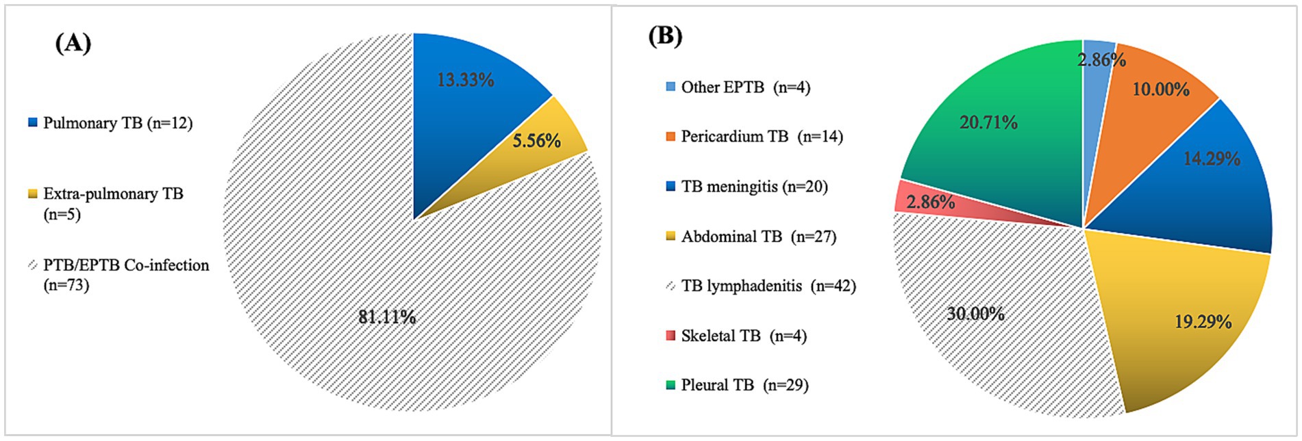 Two pie charts labeled A and B display data on tuberculosis. Chart A shows 81.11% PTB/EPTB co-infection, 13.33% pulmonary TB, and 5.56% extra-pulmonary TB. Chart B illustrates 30% TB lymphadenitis, 20.71% pleural TB, 19.29% abdominal TB, 14.29% TB meningitis, 10% pericardium TB, and smaller portions for skeletal TB and other EPTB.