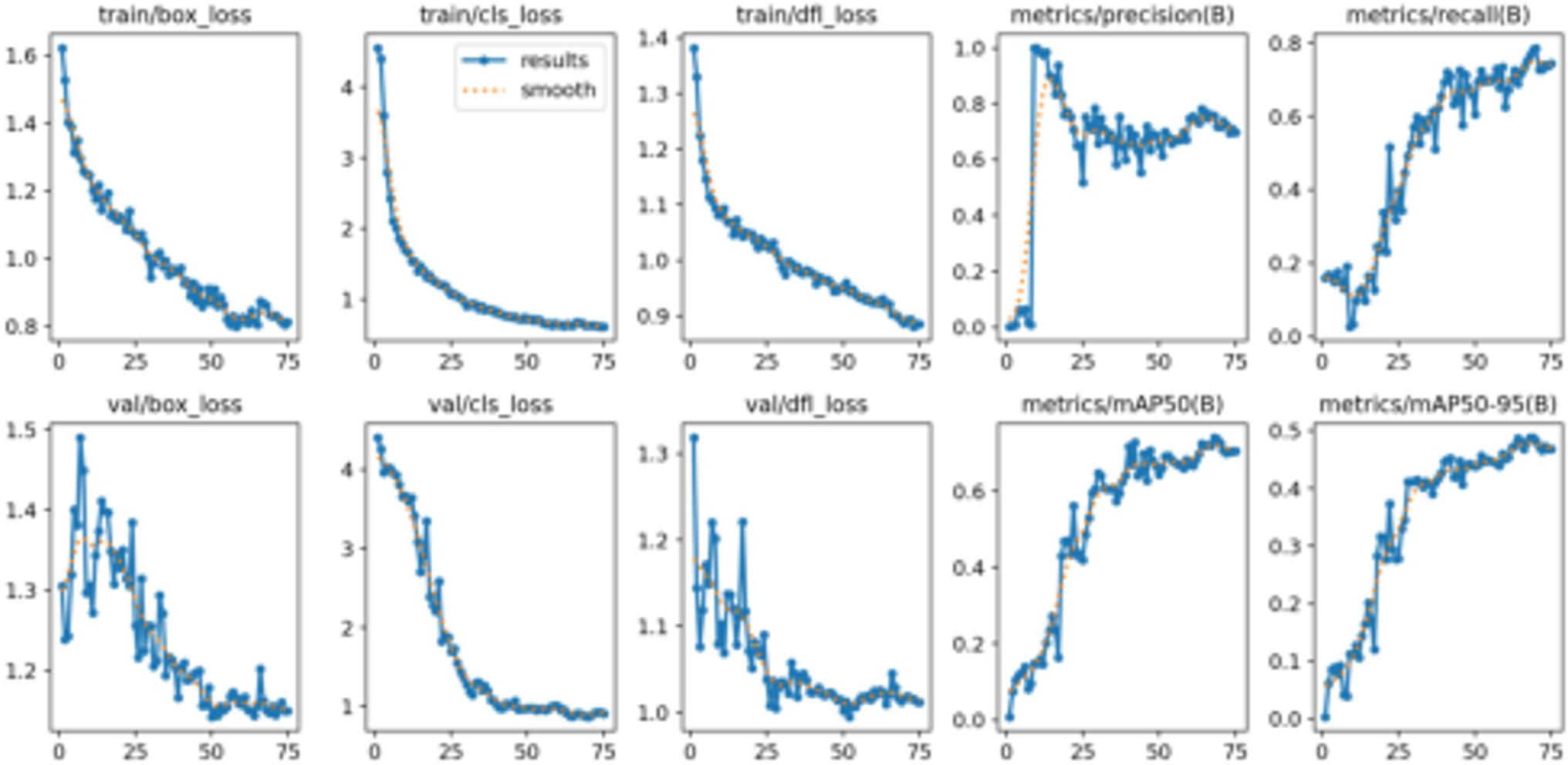 Eight line graphs showing training and validation metrics over 75 epochs. Top row: train/box_loss, train/cls_loss, train/dfl_loss, metrics for precision and recall. Bottom row: val/box_loss, val/cls_loss, val/dfl_loss, metrics for mAP50 and mAP50-95. Training losses decrease steadily, while precision, recall, and mean average precision metrics generally increase.