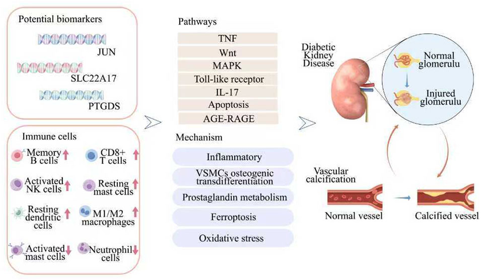 Diagram illustrating factors associated with diabetic kidney disease. It includes potential biomarkers: JUN, SLC22A17, PTGDS; immune cells like memory B cells and CD8+ T cells; pathways including TNF and MAPK. The diagram shows mechanisms such as inflammation and oxidative stress, and depicts kidney damage with normal and injured glomeruli, along with vascular calcification from a normal to a calcified vessel.
