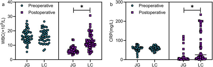 Graphs comparing preoperative and postoperative measures. Panel (a) shows white blood cell counts (x10^9/L) for JG and LC groups, with postoperative values higher, indicated by asterisk. Panel (b) displays C-reactive protein levels (mg/L), again showing higher postoperative values in the LC group, marked by an asterisk.