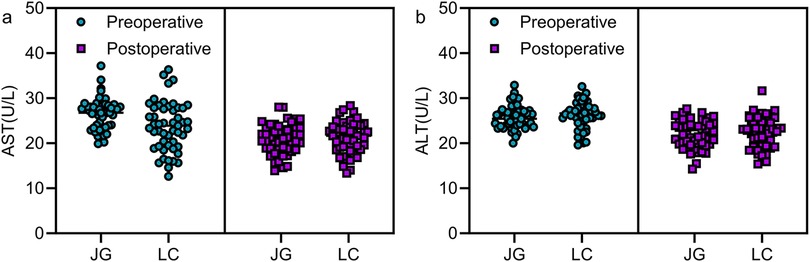Scatter plot comparing AST and ALT levels preoperatively and postoperatively for two groups, JG and LC. Panel a shows AST levels with blue circles for preoperative and purple squares for postoperative. Panel b shows ALT levels with the same color scheme. Preoperative levels are generally higher than postoperative levels for both groups.
