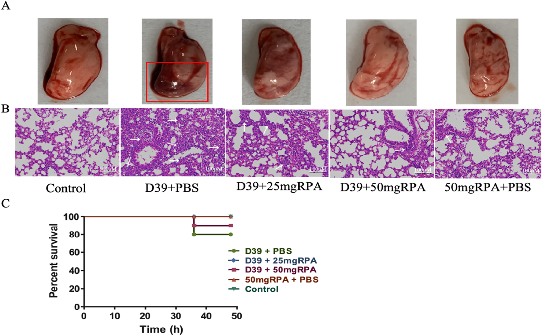 Panel A shows five spleens under different conditions. Panel B consists of five histological images of lung tissue with varying levels of inflammation, labeled Control, D39+PBS, D39+25mgRPA, D39+50mgRPA, and 50mgRPA+PBS. Panel C presents a line graph comparing survival rates over 50 hours, with lines representing D39+PBS, D39+25mgRPA, D39+50mgRPA, 50mgRPA+PBS, and Control.