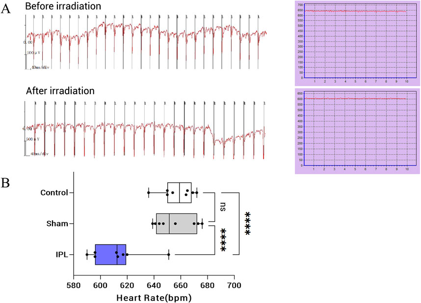 Electrocardiogram traces showing heart activity before and after irradiation are displayed on the left, with corresponding line graphs on the right. A box plot below compares heart rates across Control, Sham, and IPL groups, with significant differences indicated by asterisks.