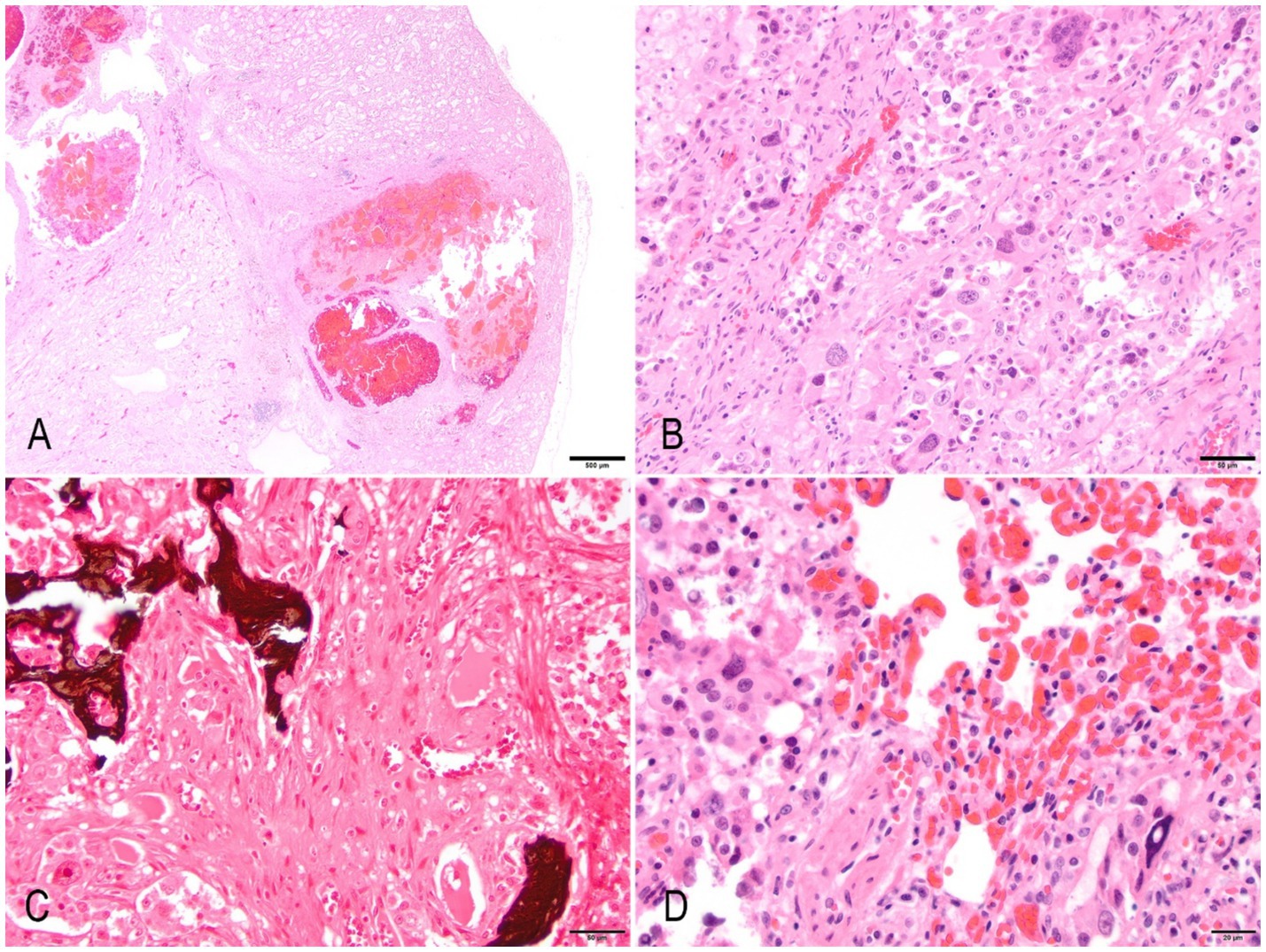 Histological images show various tissue structures stained in pink and purple. Panel A reveals coarse tissue clusters; B shows densely packed cells; C displays distinct fibrous patterns with dark sections; D highlights red blood cells among cellular structures.