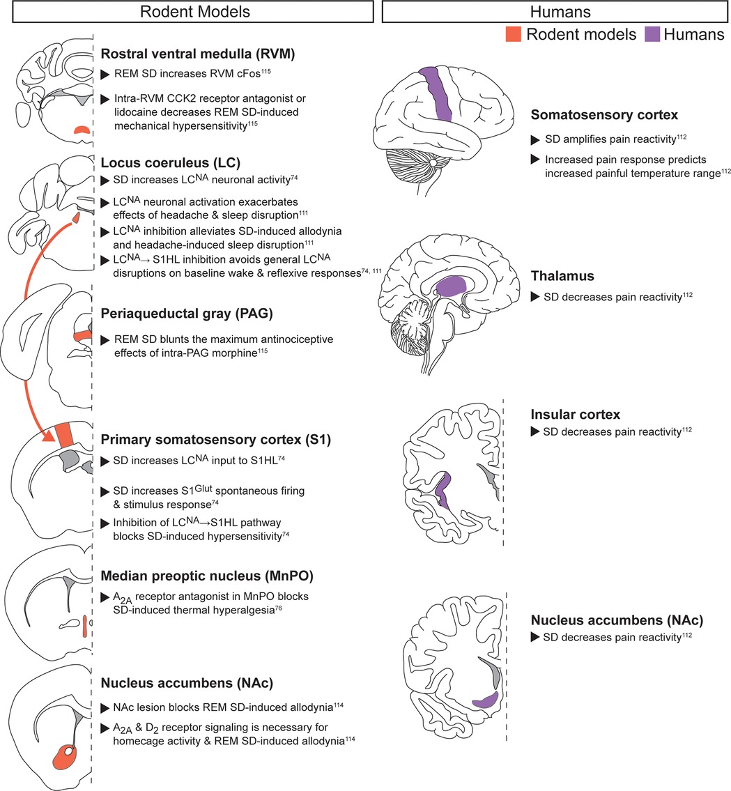Diagram comparing brain regions implicated in acute noxious stimuli with acute sleep disruption in rodent models and humans. Data from rodent models are on the left, and data from human models are on the right. Color coding highlights regions in rodents (red) and humans (purple).