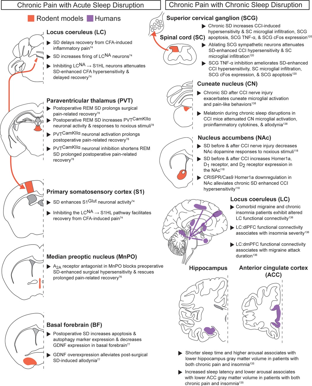 Diagram comparing brain regions implicated in chronic pain with acute or chronic sleep disruption in rodent models and humans. Data for acute sleep disruption are on the left, and data for chronic sleep disruption are on the right. Color coding highlights regions in rodents (red) and humans (purple).
