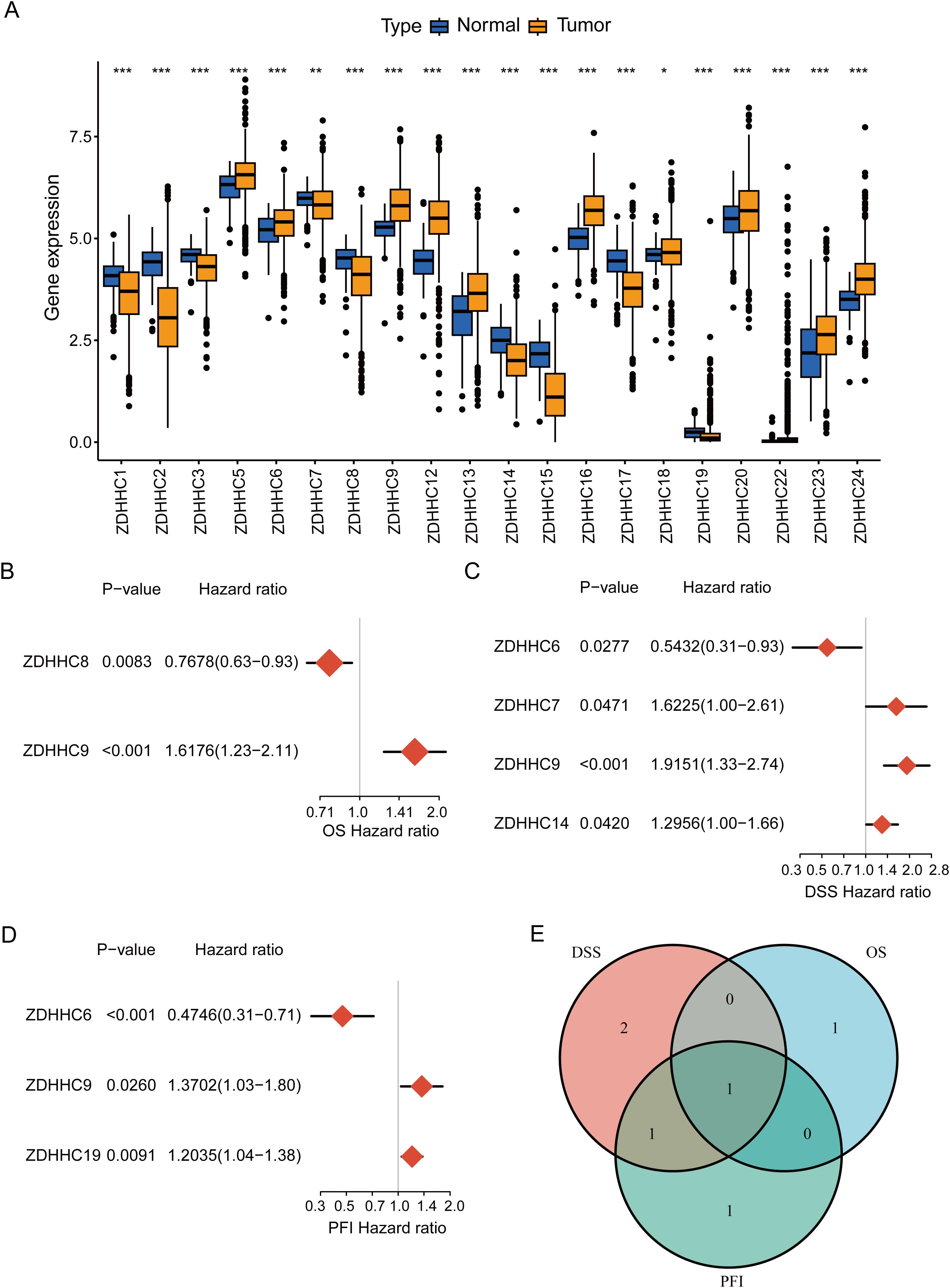 Box plots and forest plots show gene expression and hazard ratios for various ZDHHC genes in normal and tumor samples. Panel A displays gene expression differences. Panels B, C, and D show hazard ratios with p-values for overall survival (OS), disease-specific survival (DSS), and progression-free interval (PFI). Panel E is a Venn diagram indicating common and unique genes among DSS, OS, and PFI datasets.