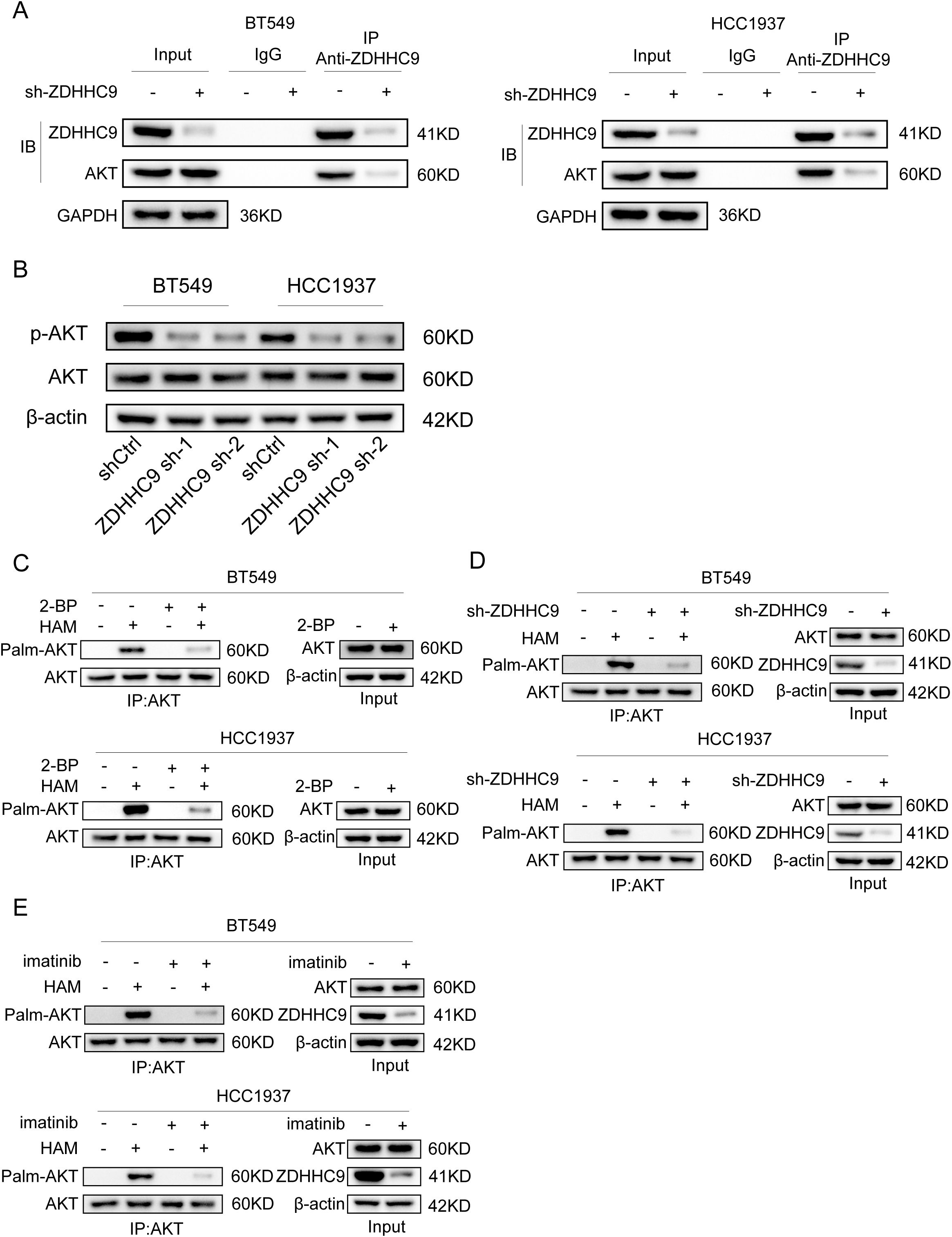 Western blot analysis displaying various protein expressions across different conditions in BT549 and HCC1937 cell lines. Panel A investigates ZDHHC9, AKT, and GAPDH levels using input, IgG, and anti-ZDHHC9 IP. Panel B examines p-AKT, AKT, and β-actin expressions under different shRNA conditions. Panels C, D, and E analyze the impact of treatments 2-BP, HAM, sh-ZDHHC9, and imatinib on Palm-AKT, AKT, ZDHHC9, and β-actin, with specific focus on AKT immunoprecipitation. Protein sizes are indicated in kilodaltons (KD).