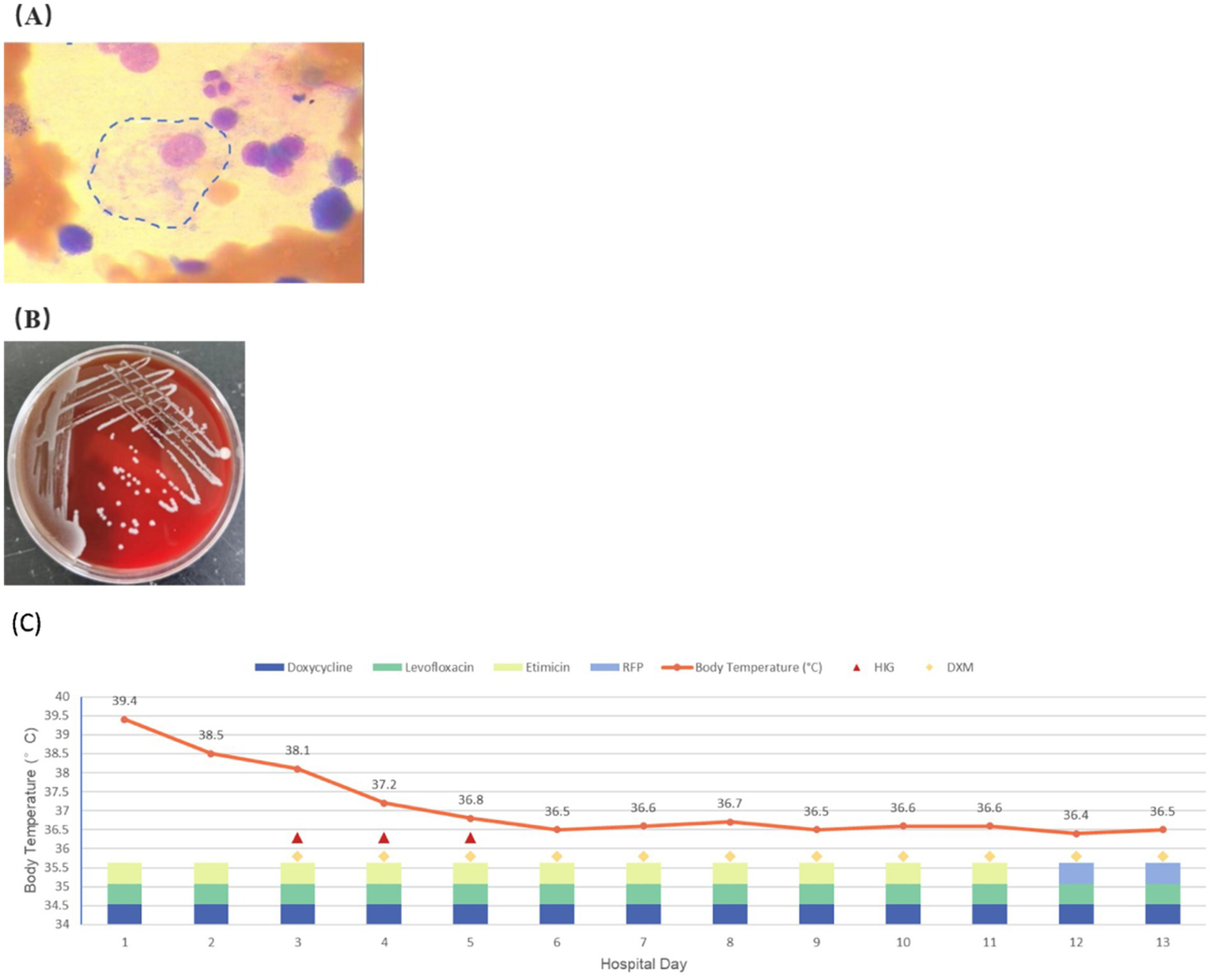Three images labeled A, B, and C. A shows a microscopic view with cells highlighted by a dashed outline. B depicts bacterial colonies on a red agar plate with streak marks. C is a line graph showing body temperature trends during hospital days with various medications listed, including doxycycline and levofloxacin.