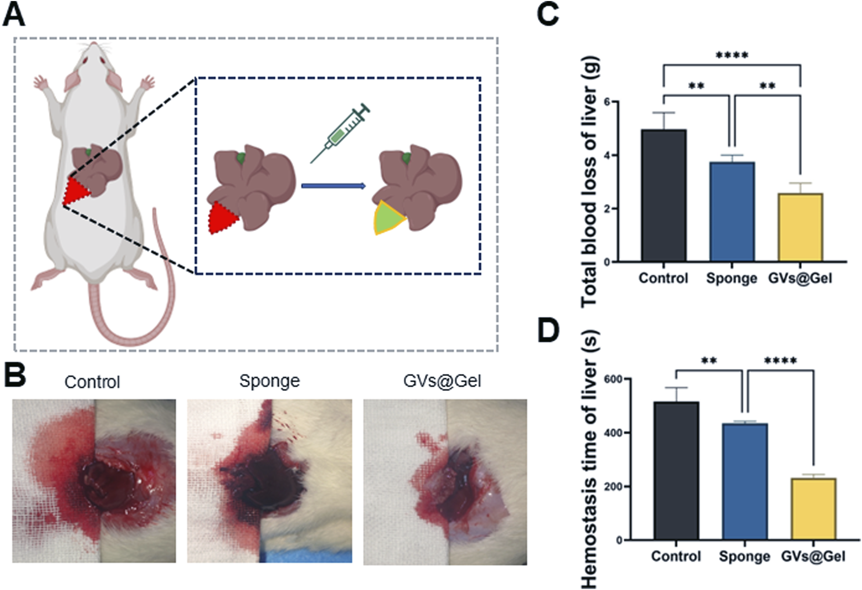 Diagram showing a liver treatment study on a rat. Panel A shows a schematic of liver injury treatment. Panel B displays images of the injury under different treatments: Control, Sponge, and GVs@Gel. Panel C is a bar graph comparing total blood loss among treatments, with GVs@Gel showing the least. Panel D is a bar graph showing the hemostasis time, with GVs@Gel achieving the quickest result. Statistical significance is indicated with asterisks.