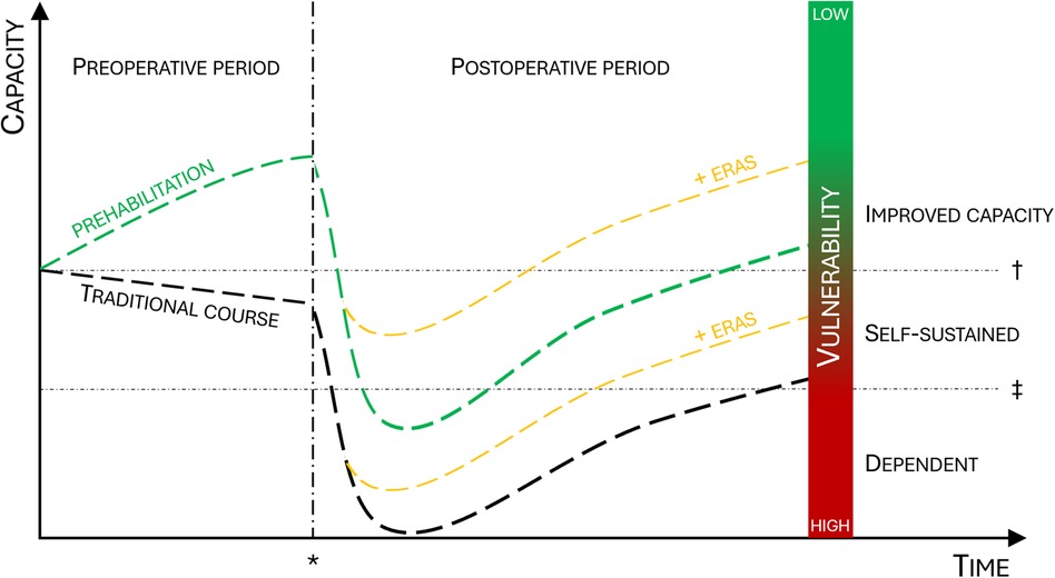 Graph showing capacity over time during pre- and postoperative periods. With prehabilitation the patients gain capacity prior to surgery when compared to a traditional course. This reduce vulnerability. ERAS further ads to this reduction in vulnerability.