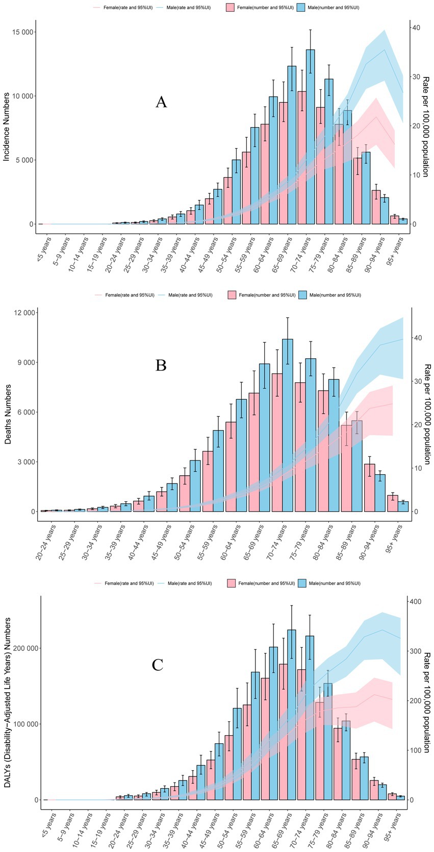 Three bar charts titled A, B, and C display data on incidence numbers, death numbers, and Disability-Adjusted Life Years (DALYs) respectively, segmented by age and gender. Pink represents female data, and blue represents male data, with shaded areas indicating rates and 95% uncertainty intervals. Each chart shows an increasing trend with age, peaking in the older age groups, with males generally having higher rates than females.