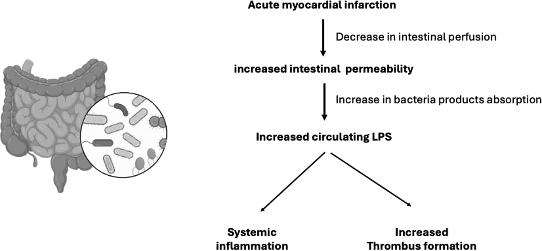 Flowchart illustrating the impact of acute myocardial infarction on intestinal health. Decrease in intestinal perfusion leads to increased intestinal permeability, causing increased circulating LPS. This results in systemic inflammation and increased thrombus formation. An intestine diagram and bacteria close-up are included.