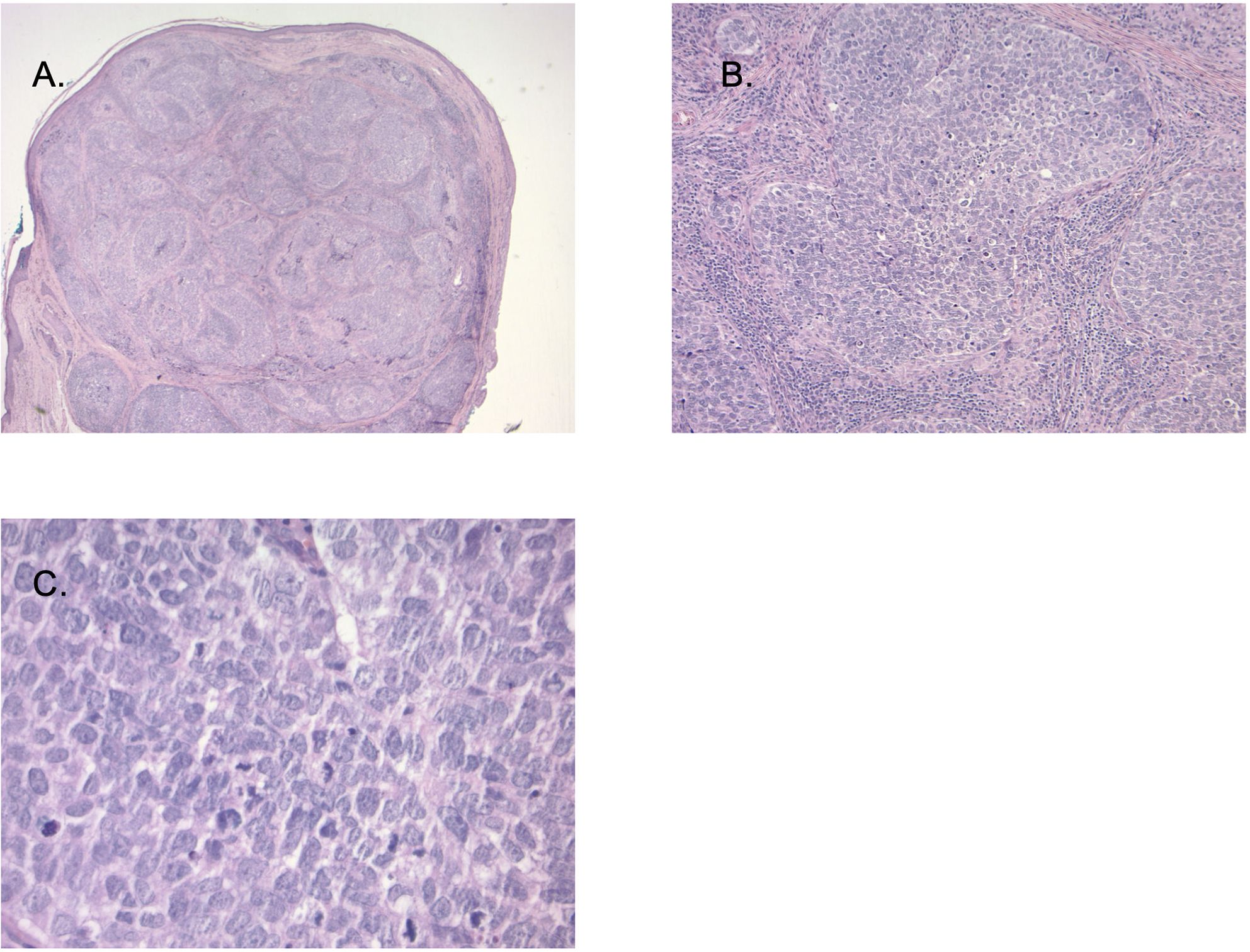 Histological slide images labeled A, B, and C showing tissue samples stained for cellular details. Image A displays a cross-section with patterned cell clusters. Image B shows densely packed cells with fibrous structures. Image C reveals a high magnification of individual cells, showing nuclear and cytoplasmic details.
