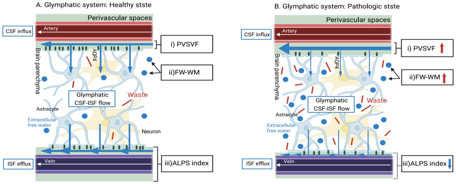 Diagram comparing healthy and pathological glymphatic systems. In the healthy state, CSF flows from arteries into the brain parenchyma and exits through veins, removing waste efficiently. Labels indicate normal perivascular spaces and free water in white matter. In the pathological state, arrows show impaired CSF flow and increased waste, with expanded perivascular spaces and white matter water content. ALPS index decreases in pathology.