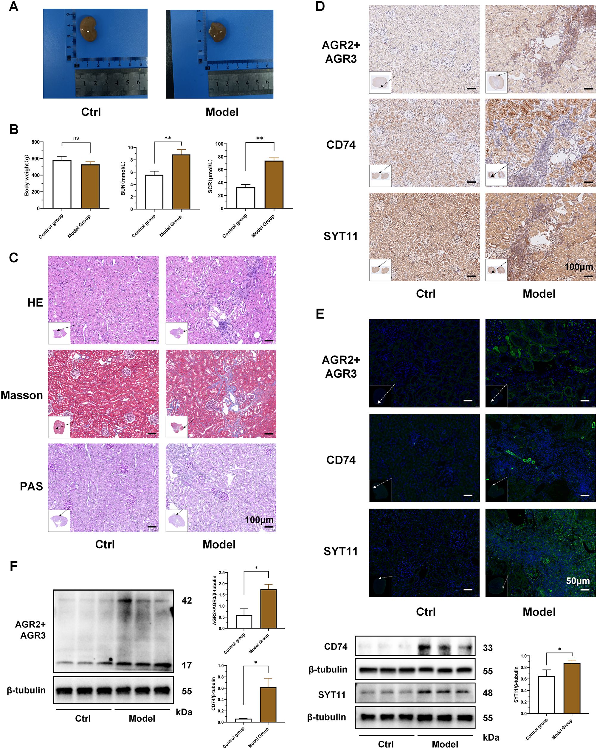 A composite scientific image displaying various analyses of control (Ctrl) and model groups. Panel A shows kidney samples with a ruler for scale. Panel B features three bar graphs comparing body weight, BUN levels, and SCR levels between the groups. Panel C includes histological images stained with HE, Masson's trichrome, and PAS, with insets. Panel D shows immunohistochemistry images labeled with AGR2+AGR3, CD74, and SYT11. Panel E presents fluorescence microscopy images with the same labels as Panel D. Panel F contains Western blot images and accompanying bar graphs quantifying protein expression levels, with β-tubulin as a loading control.