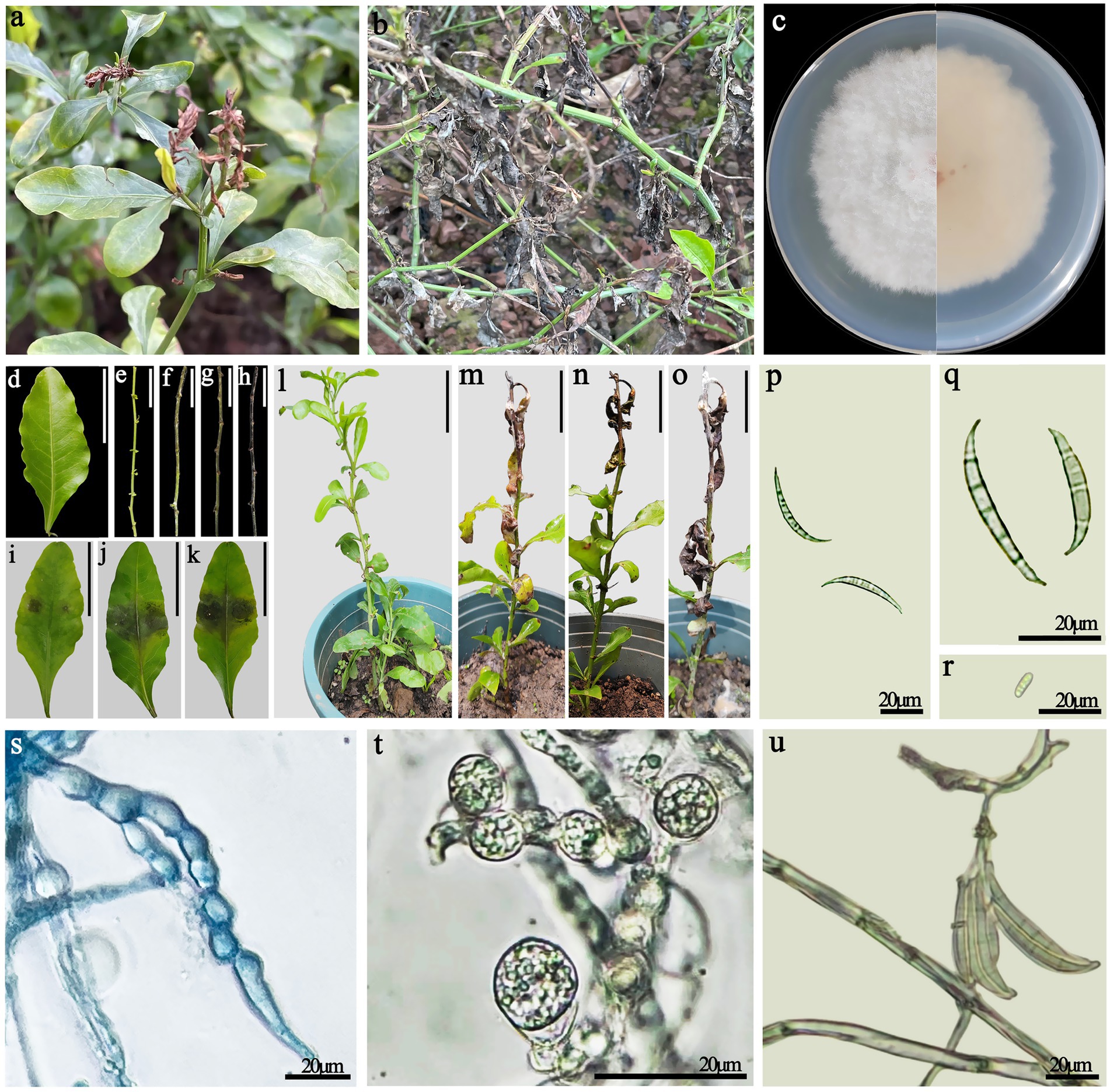 Composite image showing various stages and effects of plant disease. (a) Healthy and affected plants; noticeable browning on leaves. (b) Plant with severe disease damage.(c) Petri dish with fungal growth. (d-o) Sequence of leaf and stem symptoms including discoloration and wilting.(p-u) Microscopic views of fungal structures, showcasing spores and hyphae. Each section provides a scale reference of twenty micrometers for detail visualization.