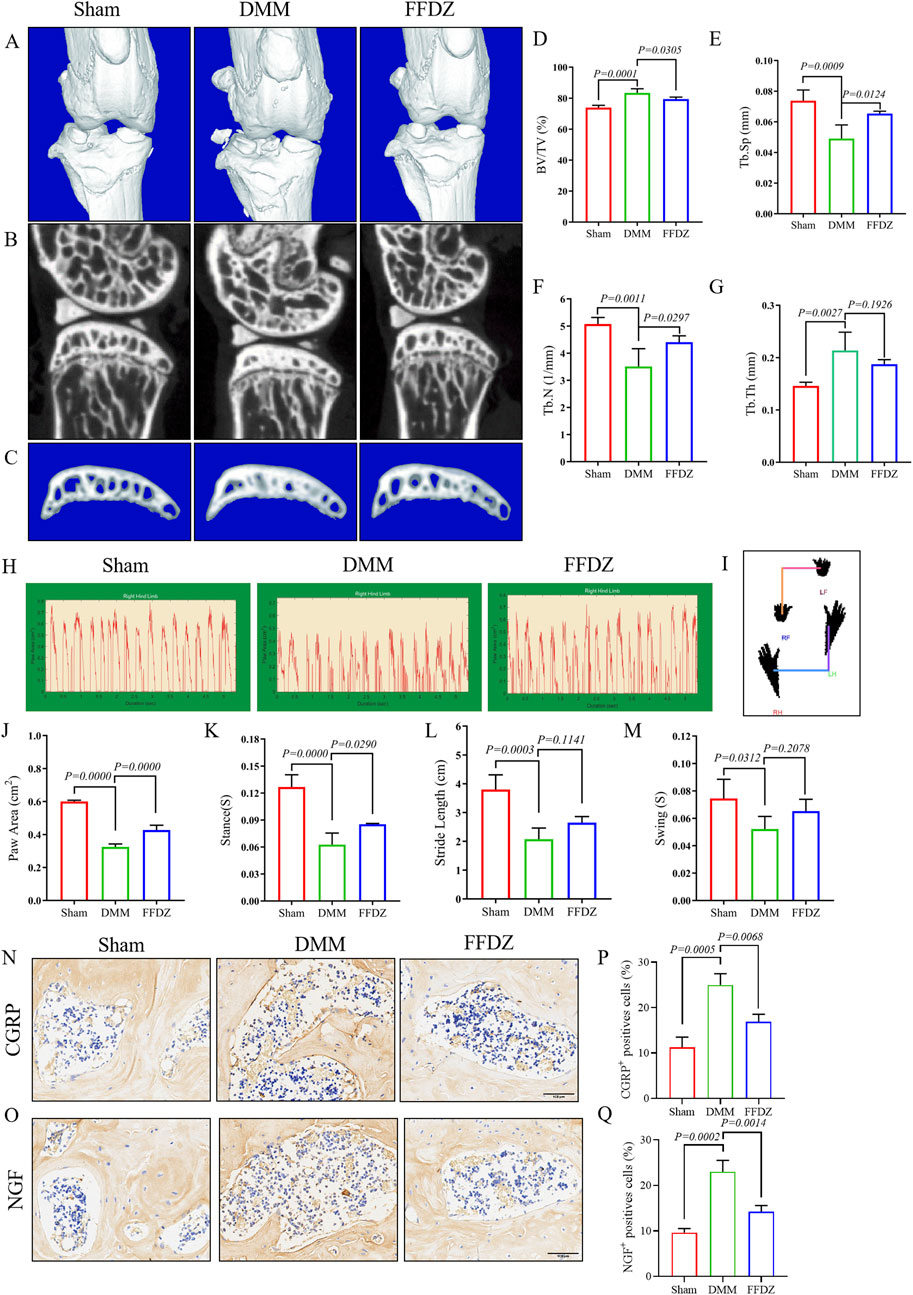 Medical data visualization showing bone structure in 3D and cross-sectional images for Sham, DMM, and FFDZ groups, alongside bar graphs with p-values depicting differences in parameters like BV/TV, Tb.Sp, Tb.N, and Tb.Th. Additional images include gait analysis graphs and immunostaining for CGRP and NGF, with related statistical data highlighting varied positive cell percentages among groups.