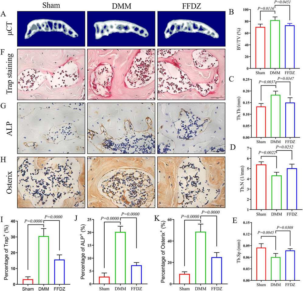 Composite image showing comparisons between Sham, DMM, and FFDZ groups. Panels A, F, G, and H depict micro-CT, Trap staining, ALP, and Osterix results, respectively. Graphs B to E show quantitative analyses of BV/TV, Tb.Th, Tb.N, and Tb.Sp, with statistical significance indicated by p-values. Bar charts I, J, and K display percentage of positive Trap, ALP, and Osterix cells, respectively, highlighting significant differences among the experimental groups.