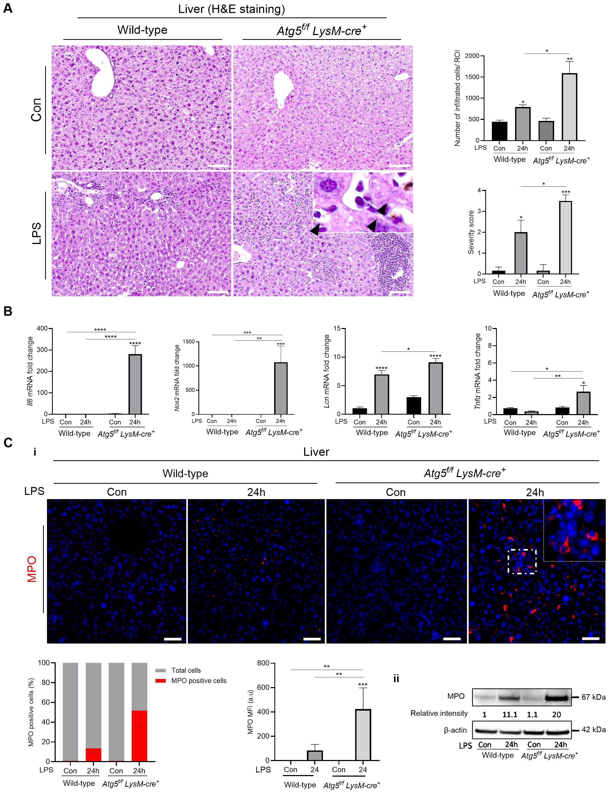 Histological and graphical analysis of liver tissue from wild-type and Atg5^f/f LysM-cre^+ mice. Panel A shows H&E stained liver sections under control and LPS conditions, with accompanying graphs displaying numbers of infiltrated cells and severity scores. Panel B presents bar graphs of mRNA fold changes for inflammatory markers IL-6, Nos2, Lcn2, and Tnfα. Panel C involves MPO staining of liver tissue, shown through immunofluorescence images and graphs indicating MPO positive cells and MFI, alongside Western blot analysis for MPO expression. Statistical significance is indicated by asterisks.