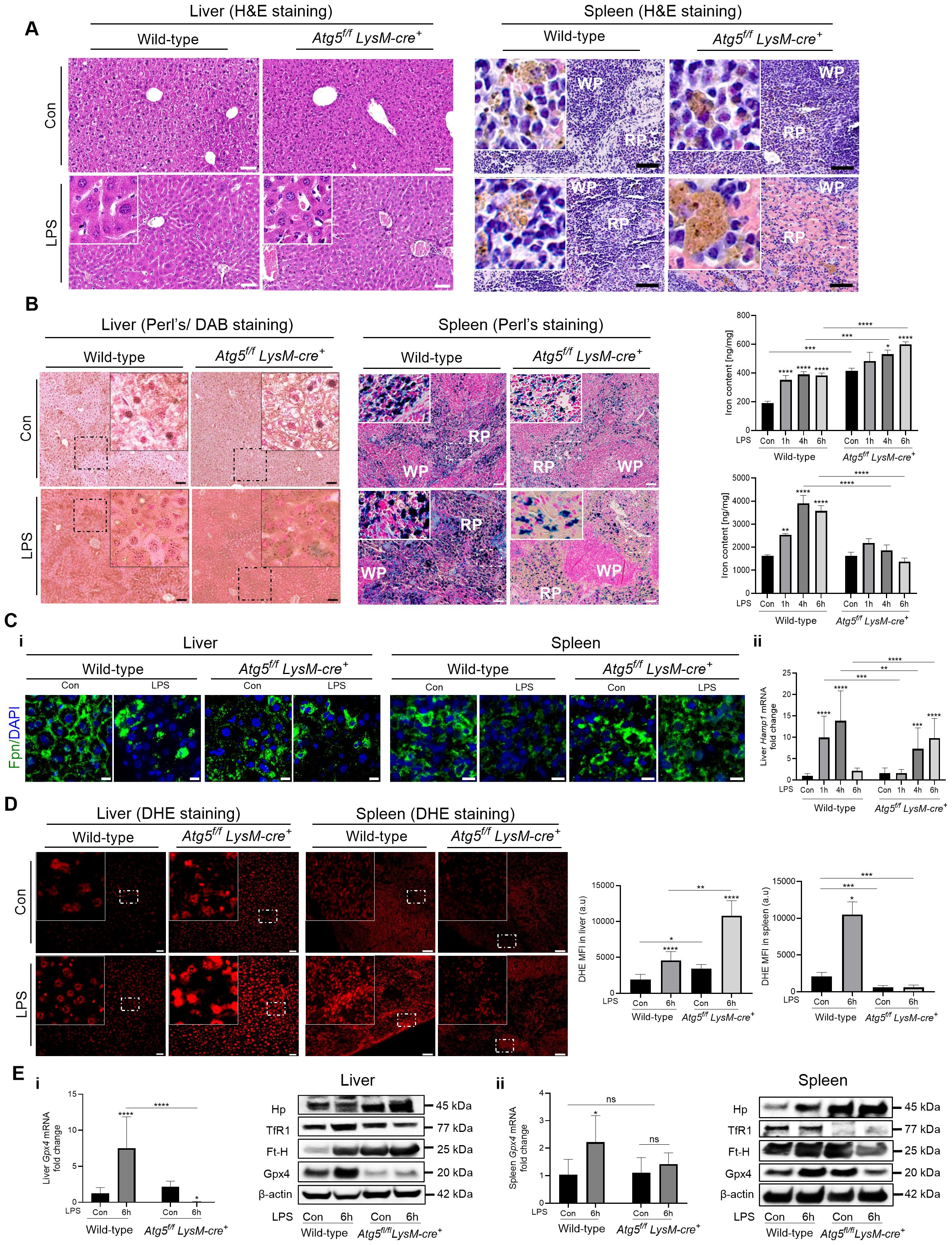 Histological analysis comparing liver and spleen tissues between wild-type and Atg5^f/f LysM-cre^+ mice under control and LPS-treated conditions. Panel A shows H&E staining, revealing tissue differences. Panel B uses Perl's/DAB staining, showing liver and spleen iron deposits with associated graphs quantifying iron levels. Panel C illustrates fluorescence staining of Fpn/DAPI, highlighting cellular structures and differences. Panel D displays DHE staining for reactive oxygen species, with a graph quantifying DHE intensity. Panel E includes mRNA and protein expression levels measured in the liver and spleen, with graphs and protein blots detailing changes.
