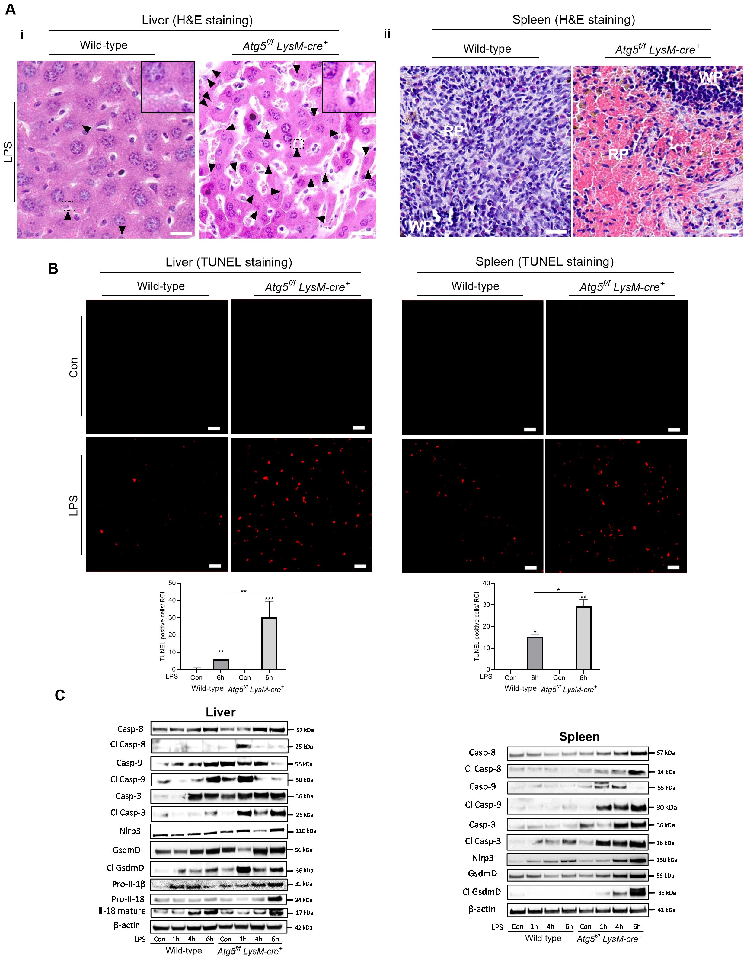 Histological and molecular analyses of liver and spleen tissues from wild-type and Atg5^f/f LysM-cre^+ mice. Panel A shows H&E staining of liver (i) and spleen (ii) tissues, highlighting morphological differences. Panel B presents TUNEL staining for apoptosis detection, with quantification graphs below for both liver and spleen. Panel C displays Western blot analysis of apoptosis-related proteins in liver and spleen tissues, comparing expression levels. Bars indicate scale in staining images, and significant differences are noted with asterisks in graphs.