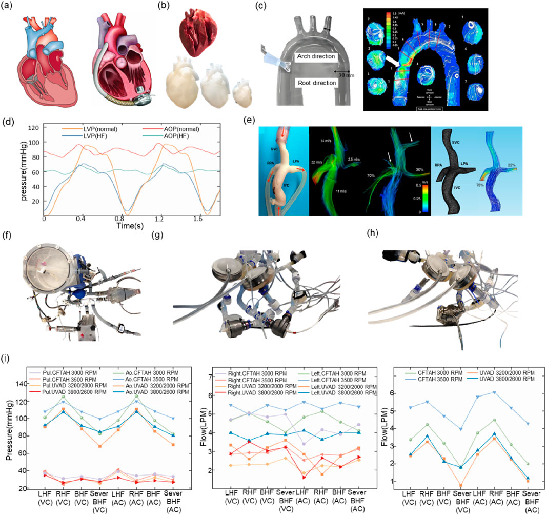 (a) Illustrations of human hearts, including anatomical and cross-section views. (b) Image of three physical heart models in different sizes. (c) Diagram showing heart directions in a CT scan and color-coded flow patterns. (d) Graph displaying blood pressure over time for left ventricle and aorta, normal and heart failure. (e) Flow dynamics in a heart model with velocity and percentage indicators. (f), (g), (h) Images of mechanical heart devices and apparatus. (i) Graphs depicting pressure and flow data across various conditions and device speeds.