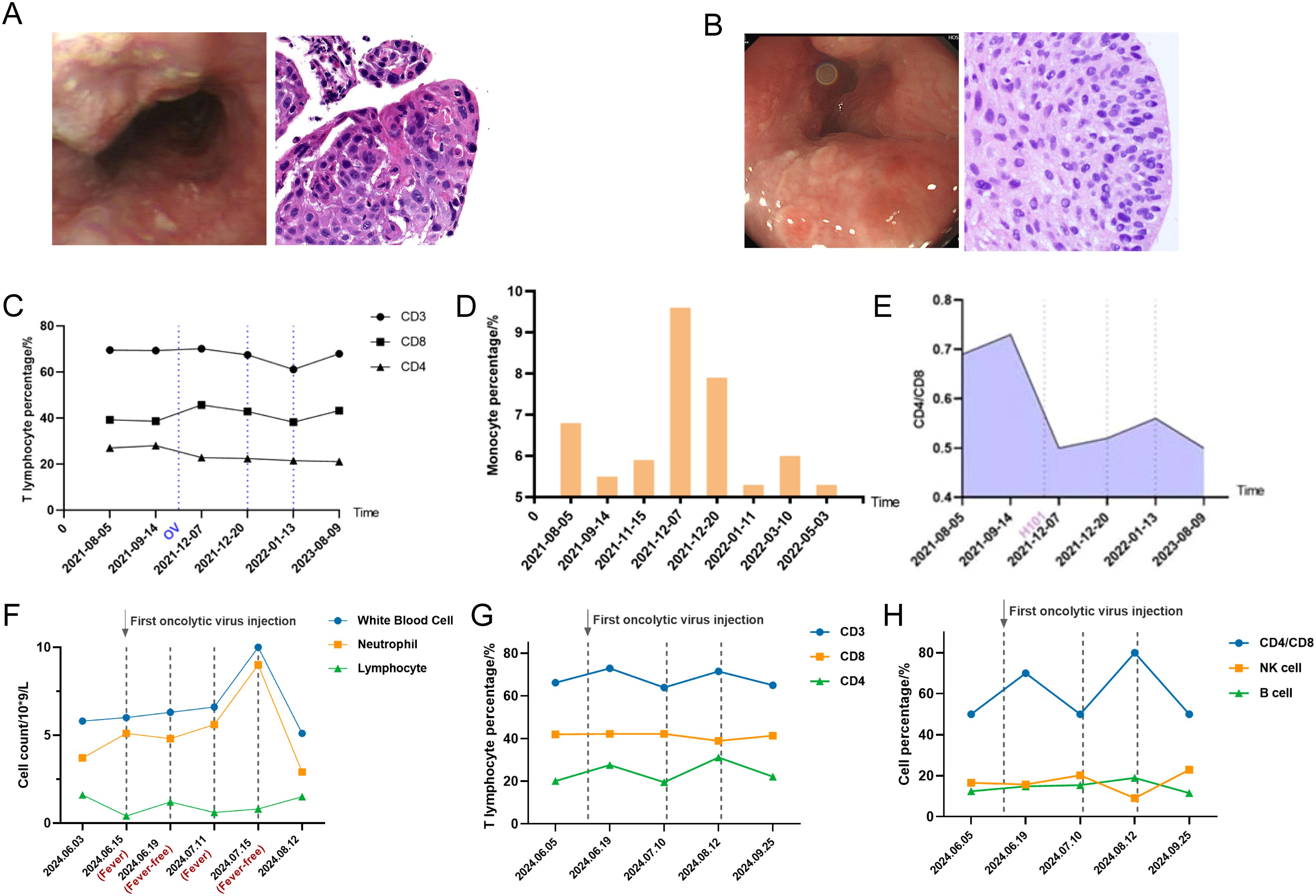 Group of images showing medical findings and data visualizations. Panel A shows endoscopic and microscopic images of tissue. Panel B presents another endoscopic and microscopic tissue image. Panels C, D, E, F, G, and H depict various graphs displaying percentages of T lymphocytes, monocytes, CD4/CD8 ratios, cell counts, and cell percentages over time, with specific interventions marked.