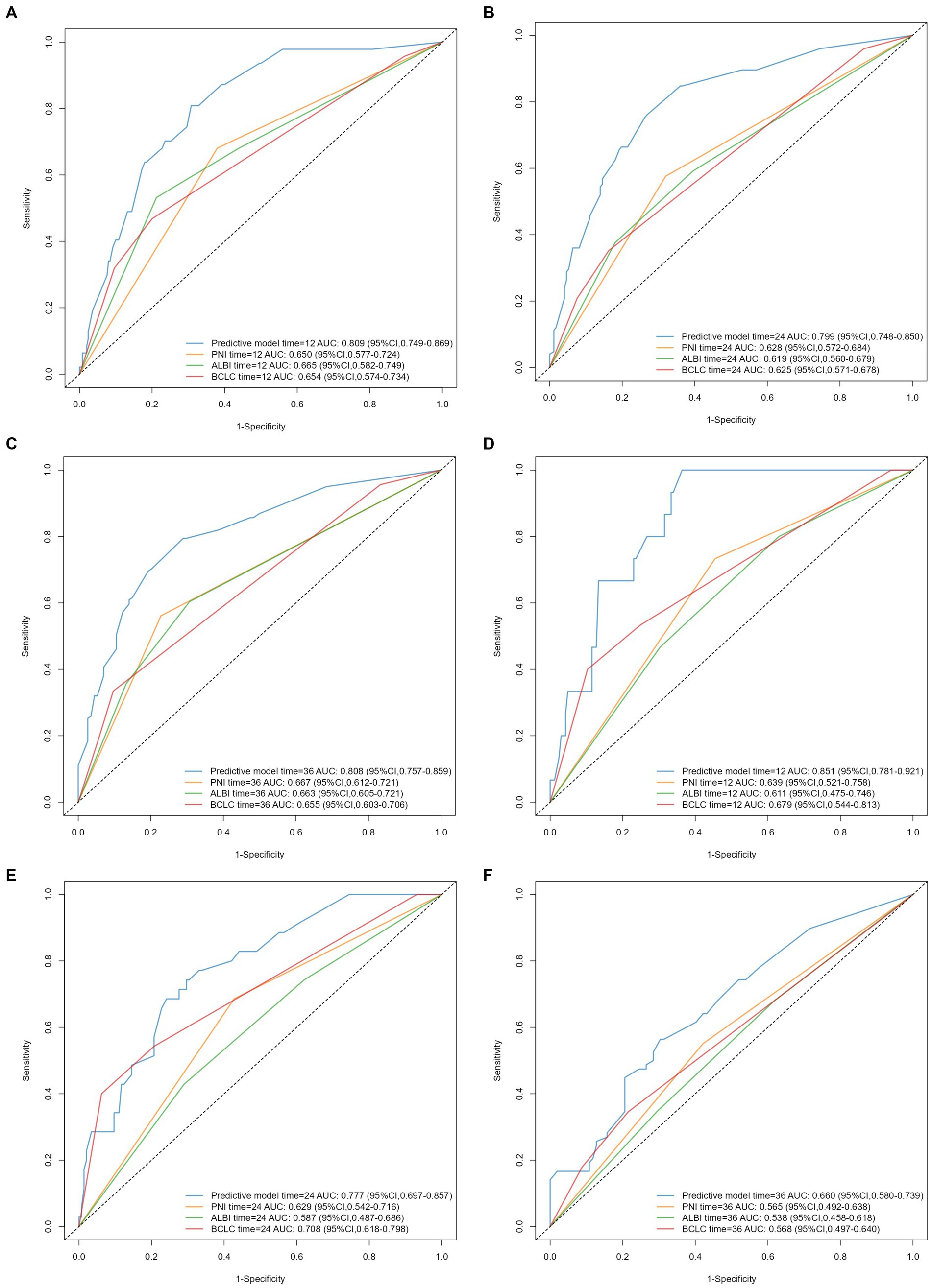 Six ROC curve graphs labeled A to F compare the predictive performance of various models over time using AUC values. Each graph shows sensitivity versus 1-specificity. The legends indicate different models with corresponding AUC values and confidence intervals, including predictive models, PNI, ALBI, and BCLC at various times like 12, 24, and 36 months. A dotted diagonal line represents random guessing.