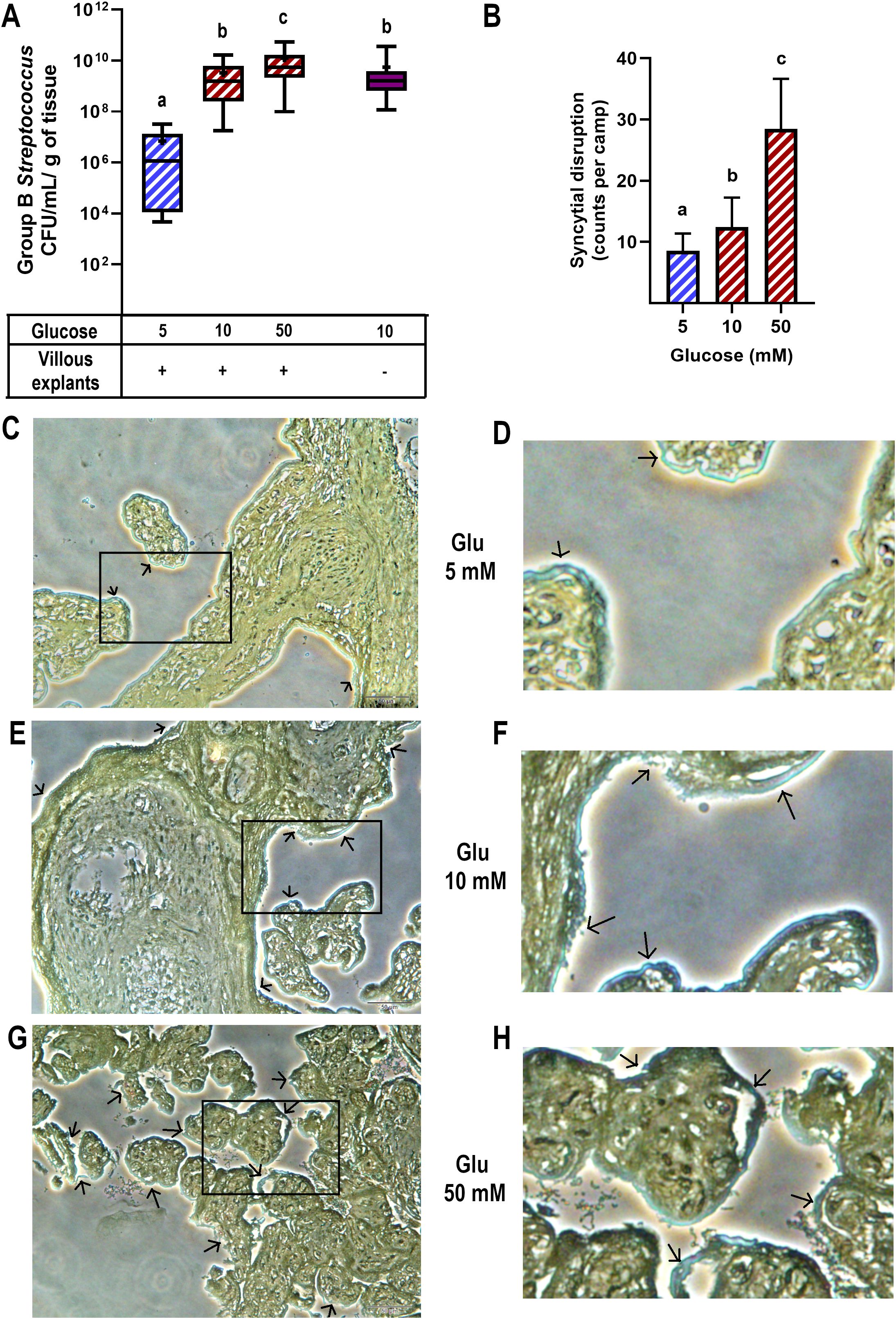 Graphs and micrographs illustrate the effects of glucose on Group B Streptococcus proliferation and syncytial disruption. Panel A shows a box plot of bacterial concentration at varying glucose levels in villous media. Panel B shows a bar graph of syncytial disruption counts per glucose concentration, with increasing counts from 5 to 50 mM Groups marked with different letters indicate significant differences. Panels C, E, and G show micrographs at 5, 10, and 50 mM glucose, respectively. Panels D, F, and H provide magnified views highlighting cellular changes marked by arrows.
