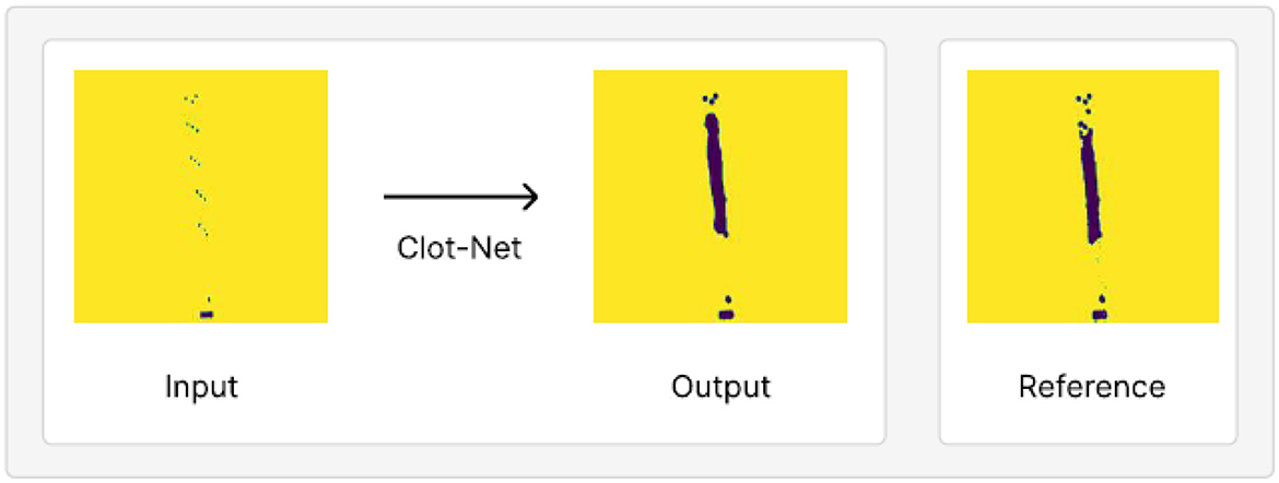 Three panels display a visual comparison. The left panel shows the “Input” with scattered green marks on a yellow background. The middle panel labeled “Output” features a purple vertical line on yellow. The right panel, labeled “Reference,” shows a similar pattern to the output, with a refined appearance. An arrow labeled “Clot-Net” connects the input and output.