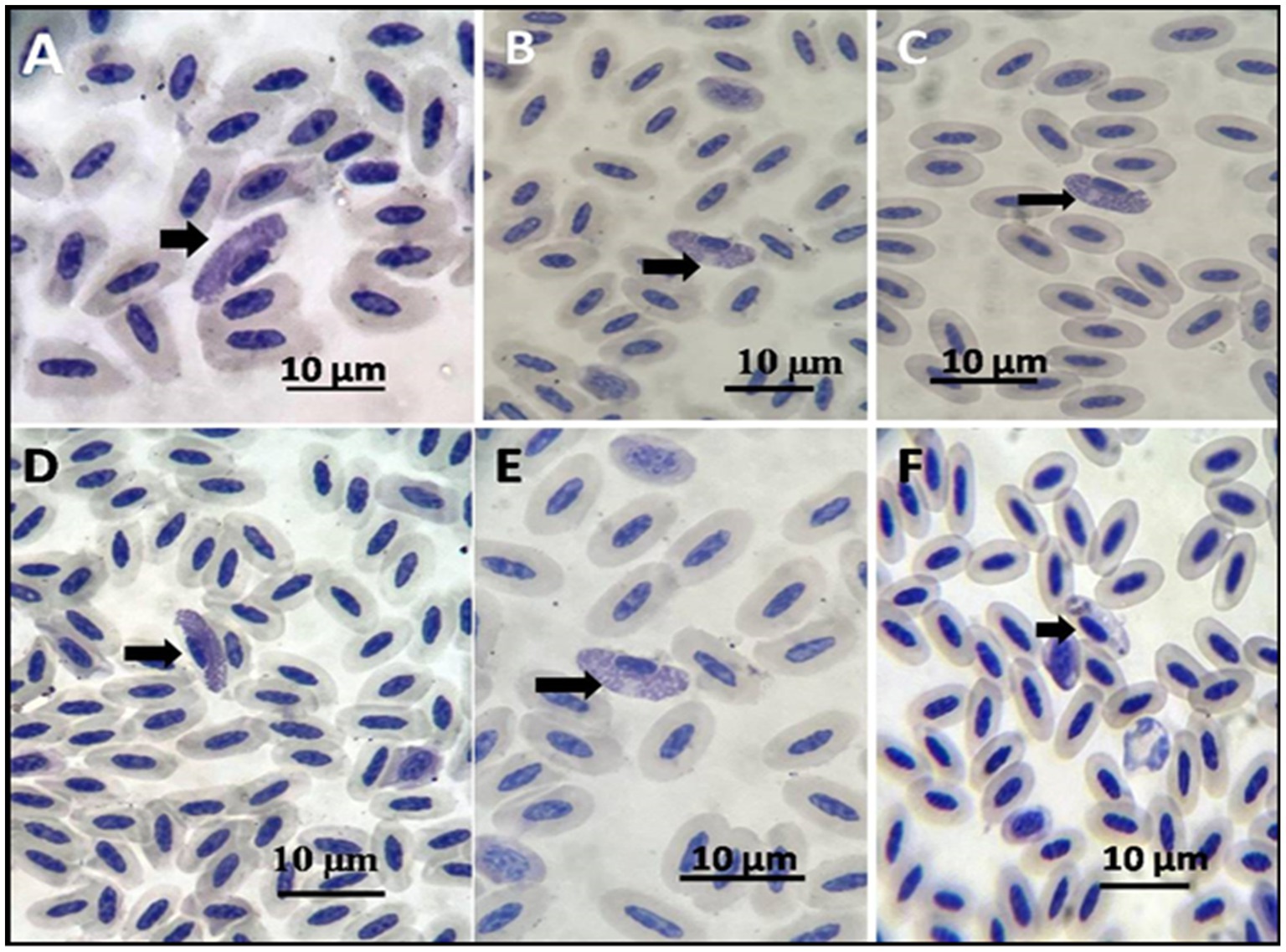 Six microscopic images of cells, labeled A to F, show oval-shaped cells stained in blue and purple. Each image has a scale of ten micrometers. Arrows indicate specific cells, likely highlighting differences or abnormalities.
