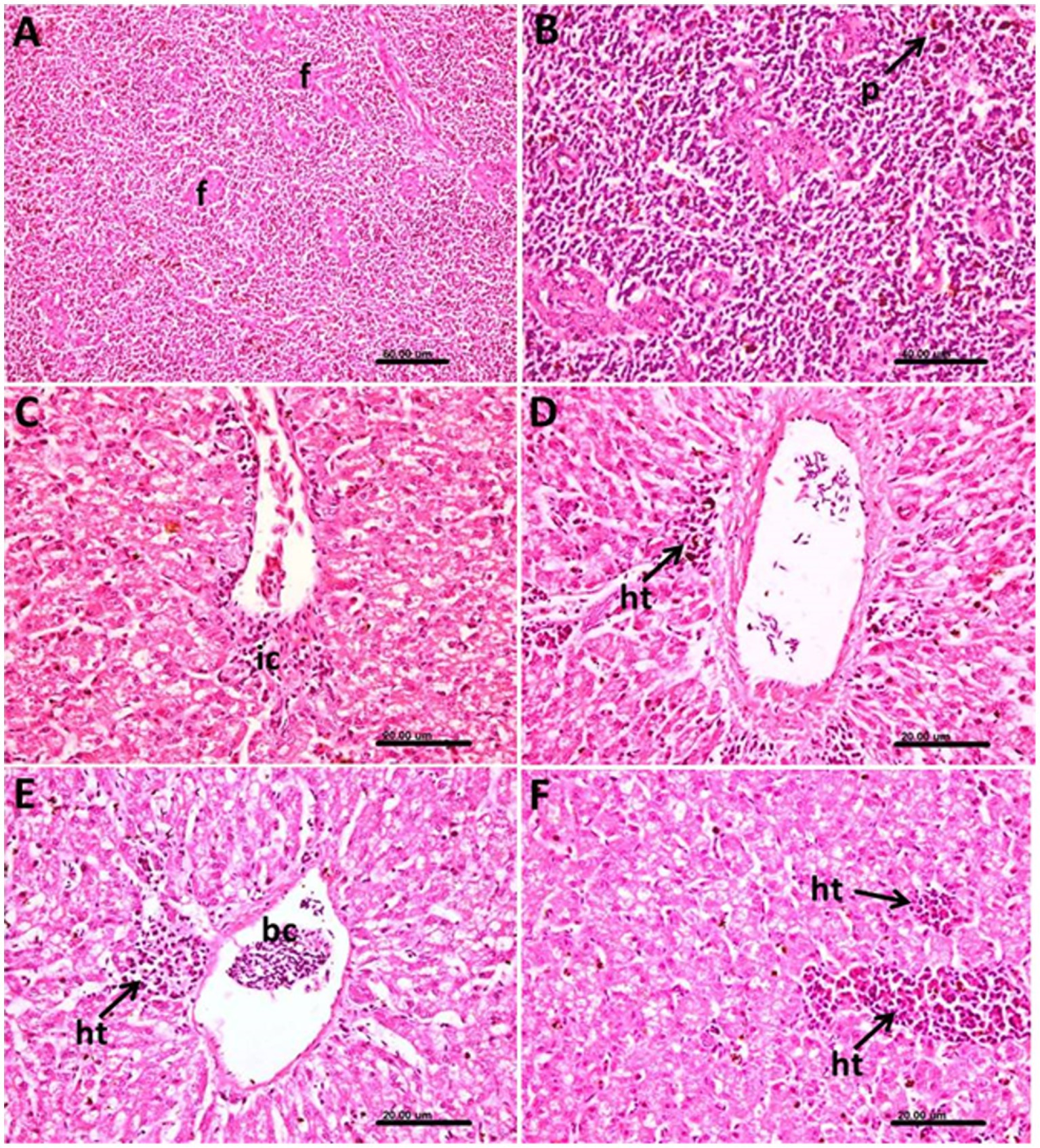 Microscopic images of liver tissue sections. Panel A shows fibrous tissue labeled