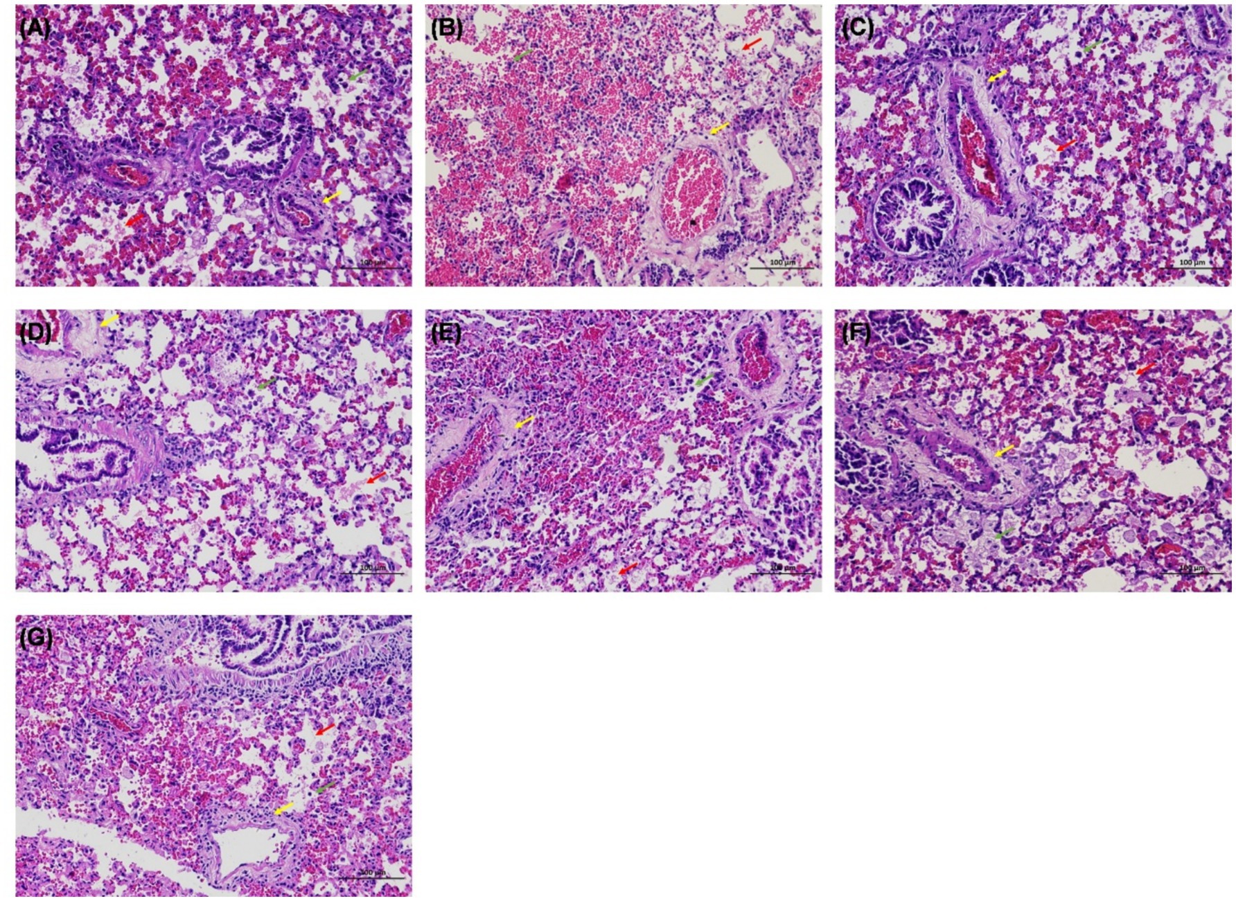Microscopic images (A-G) display lung tissue sections with varying patterns of inflammation, cellular infiltrates, and architectural details. Each section shows differences in alveolar and vascular structures, with arrows indicating focal points of cellular activity, congestion, or damage. Stains highlight tissue components, revealing alterations in lung histology.
