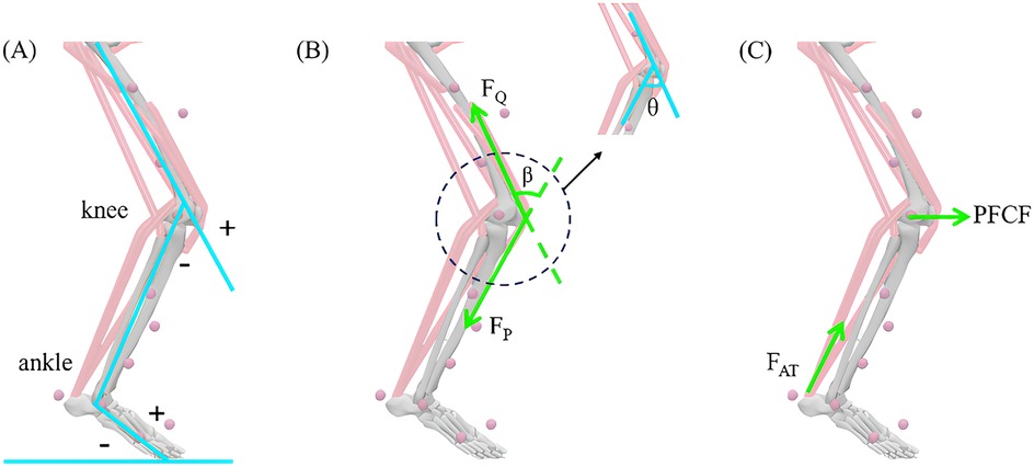 Sagittal plane angles of the three lower limb joints in the stance phase and free-body diagram of the patellofemoral joint. (A) shows the flexion angles of the knee and ankle joints. (B) illustrates the quadriceps muscle strength, the patellar ligament tension line, the angle between the quadriceps muscle line and the patellar ligament tension line, and the knee flexion angle. (C) displays the patellofemoral contact force and Achilles tendon force. The green arrows indicate the direction of the forces.