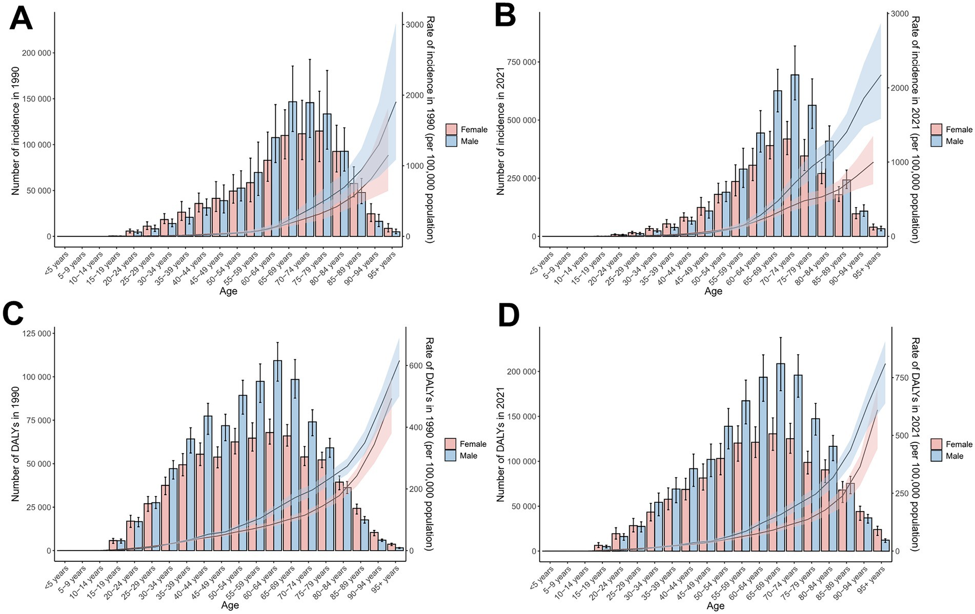 A four-panel chart shows age- and sex-specific total skin cancer burden for 1990 and 2021. Panels A and B present incidence numbers and ASIRs for 1990 and 2021, respectively; Panels C and D present DALYs and ASDRs for 1990 and 2021, respectively. Bars represent case numbers (red for females, blue for males), and lines indicate age-standardized rates. Shaded areas indicate 95% uncertainty intervals. ASIRs and ASDRs generally increase with age.