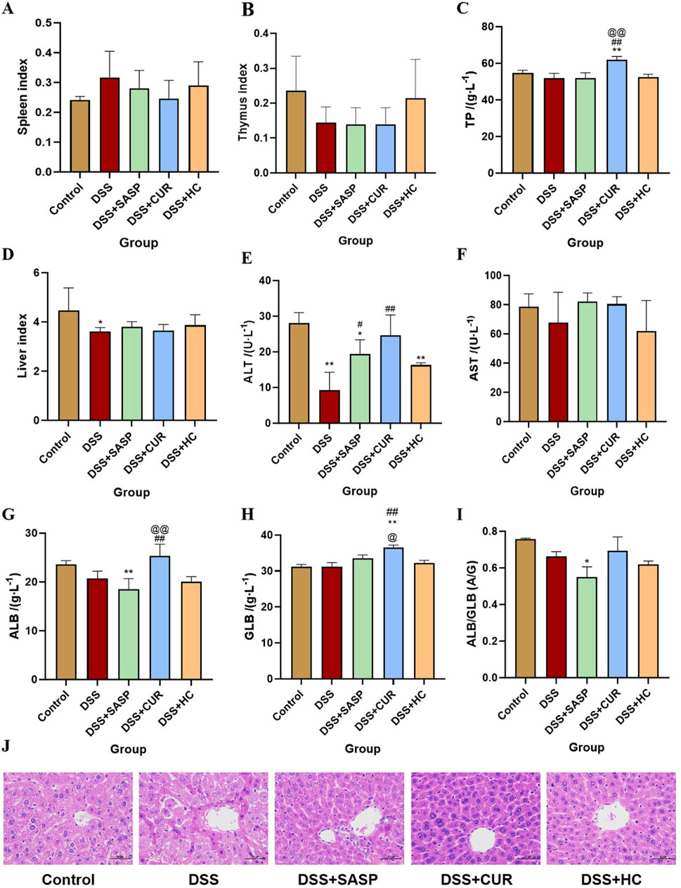 Bar charts labeled A to I show various health indices across five groups: Control, DSS, DSS+SASP, DSS+CUR, and DSS+HC. Panels include indices like Spleen, Thymus, Liver, ALT, AST, TP, ALB, GLB, and ALB/GLB ratio. Asterisks and symbols indicate significant differences. Panel J displays microscopic images of liver tissue for each group, highlighting tissue morphology differences.