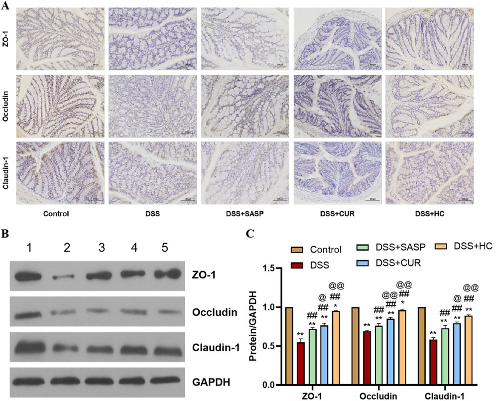 Panel A displays histological images of intestinal tissues showing ZO-1, Occludin, and Claudin-1 expression under different conditions: Control, DSS, DSS+SASP, DSS+CUR, and DSS+HC. Panel B presents a Western blot analysis of the same proteins across five treatments. Panel C is a bar graph comparing protein levels, normalized to GAPDH, for the conditions listed, using color codes. Statistical significance is indicated with symbols above the bars.