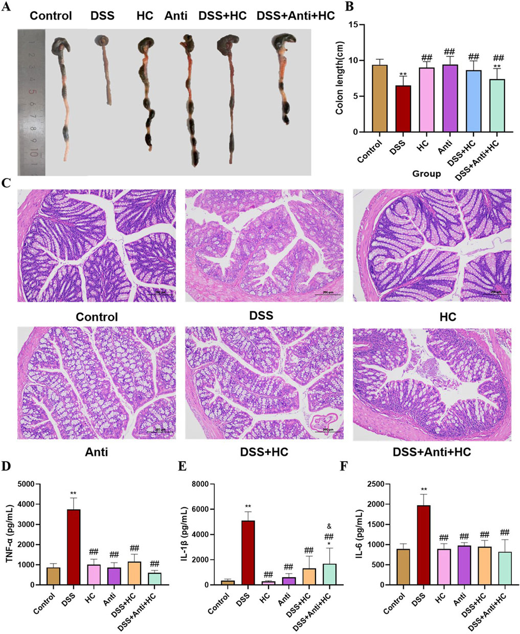 Panels show comparisons of colon samples and histological data across different treatment groups. Panel A displays colon samples labeled